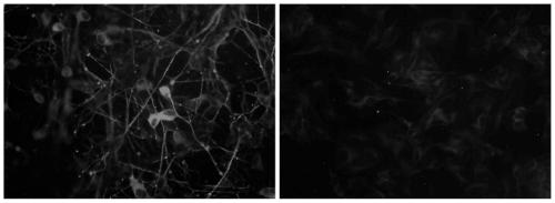 A method of inducing sh-sy5y cells to differentiate into dopaminergic neurons