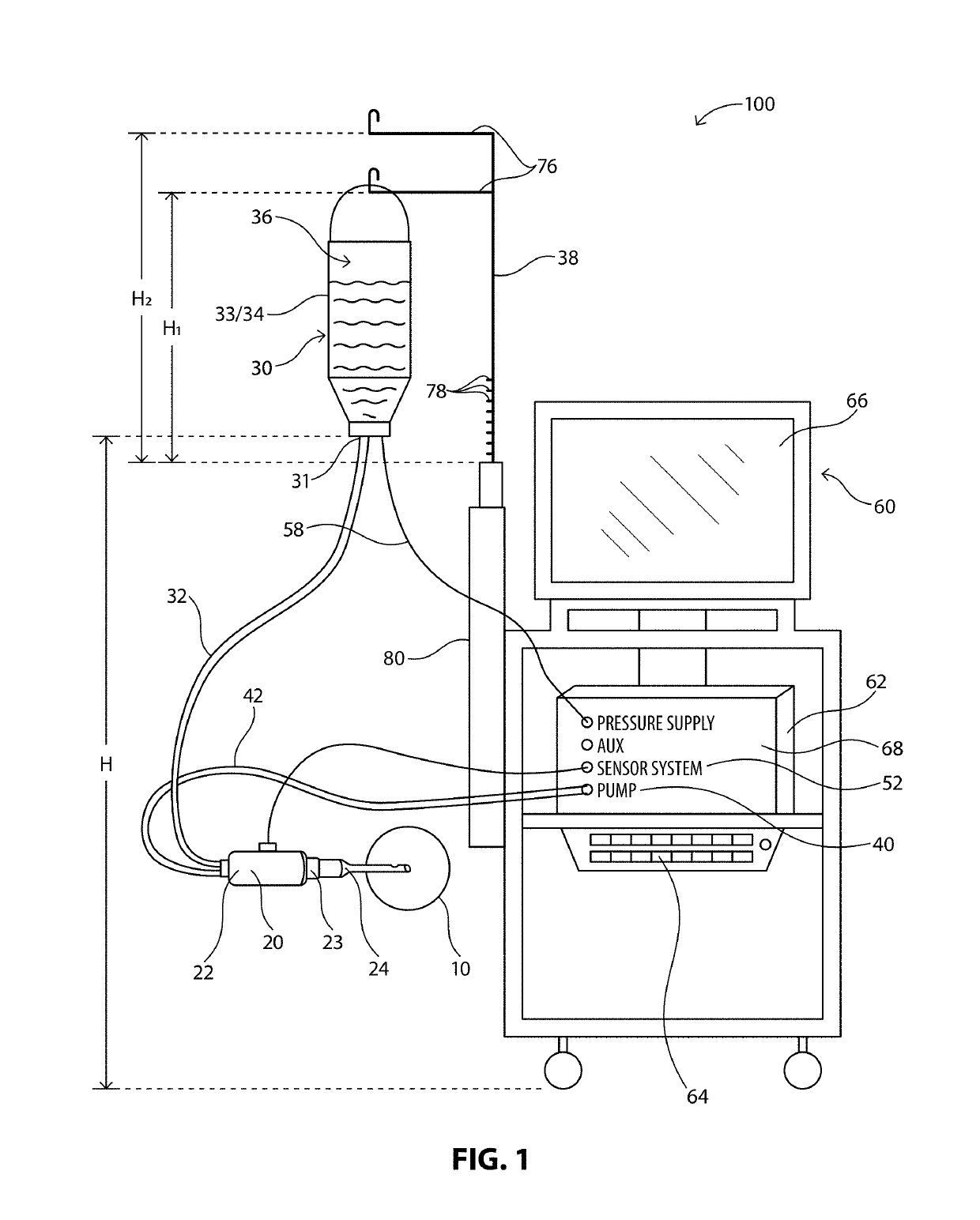 Advanced Occlusion Management Methods for a Phacoemulsification System