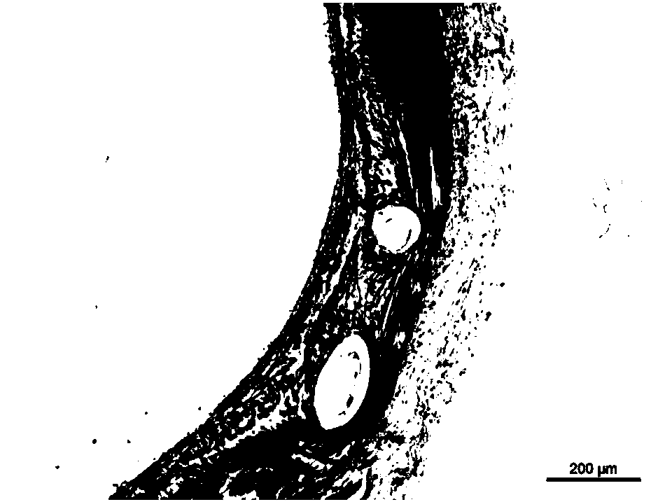 Absorbable iron-based instrument