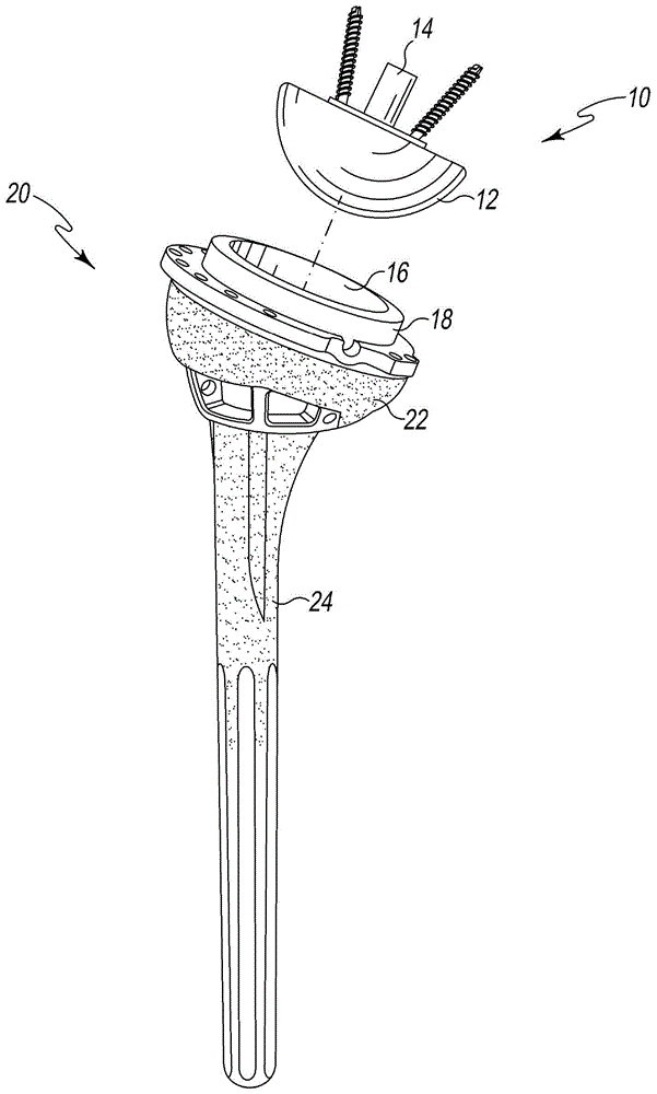 Modular reverse shoulder orthopaedic implant and method of implanting the same