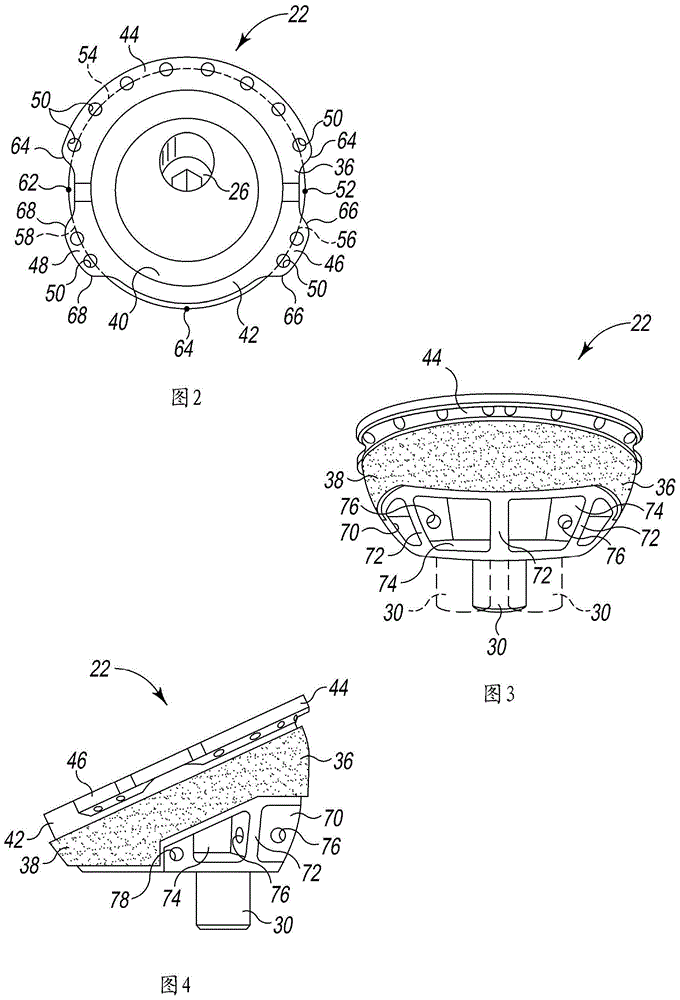 Modular reverse shoulder orthopaedic implant and method of implanting the same