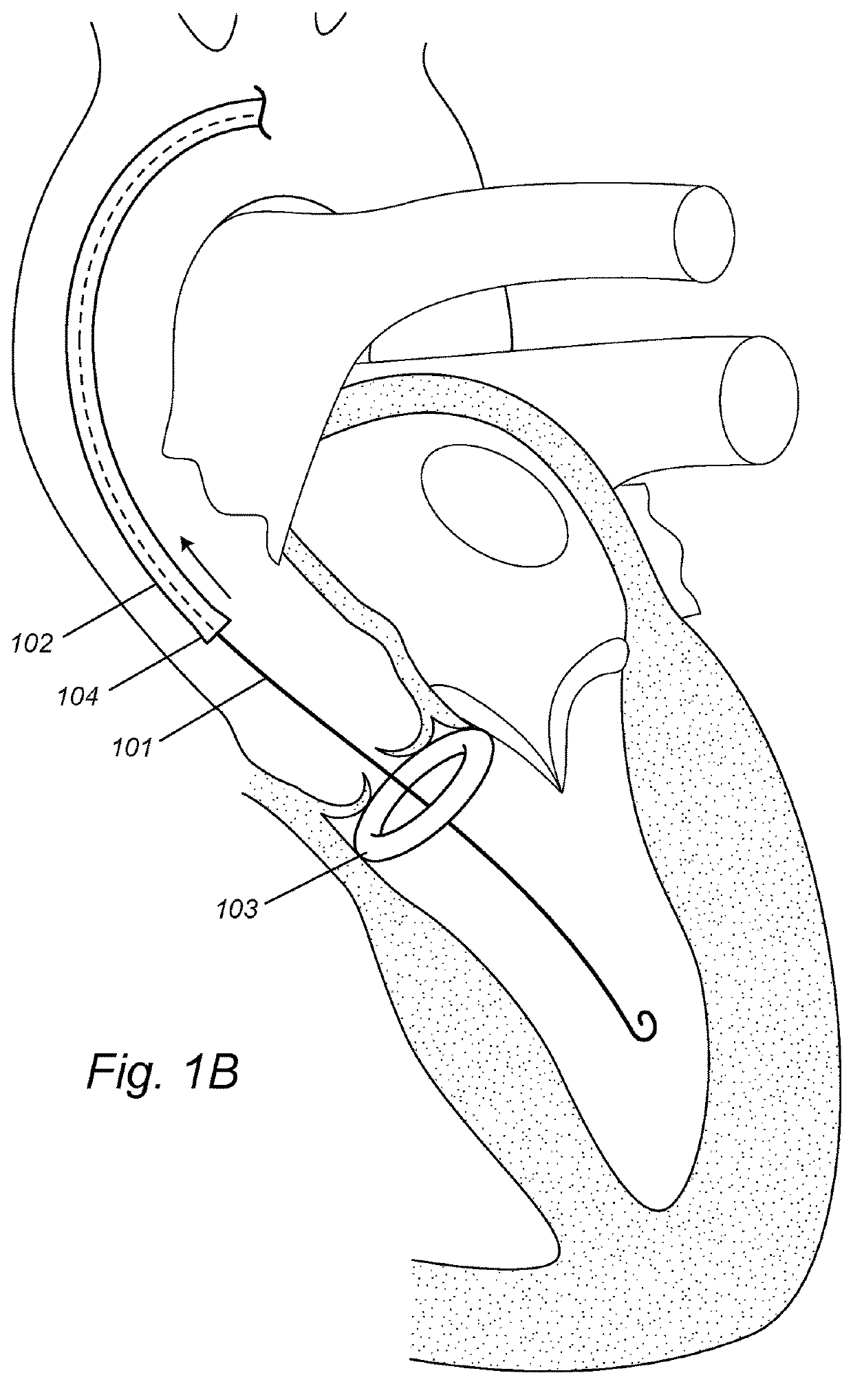 Devices, systems, and methods to optimize annular orientation of transcatheter valves