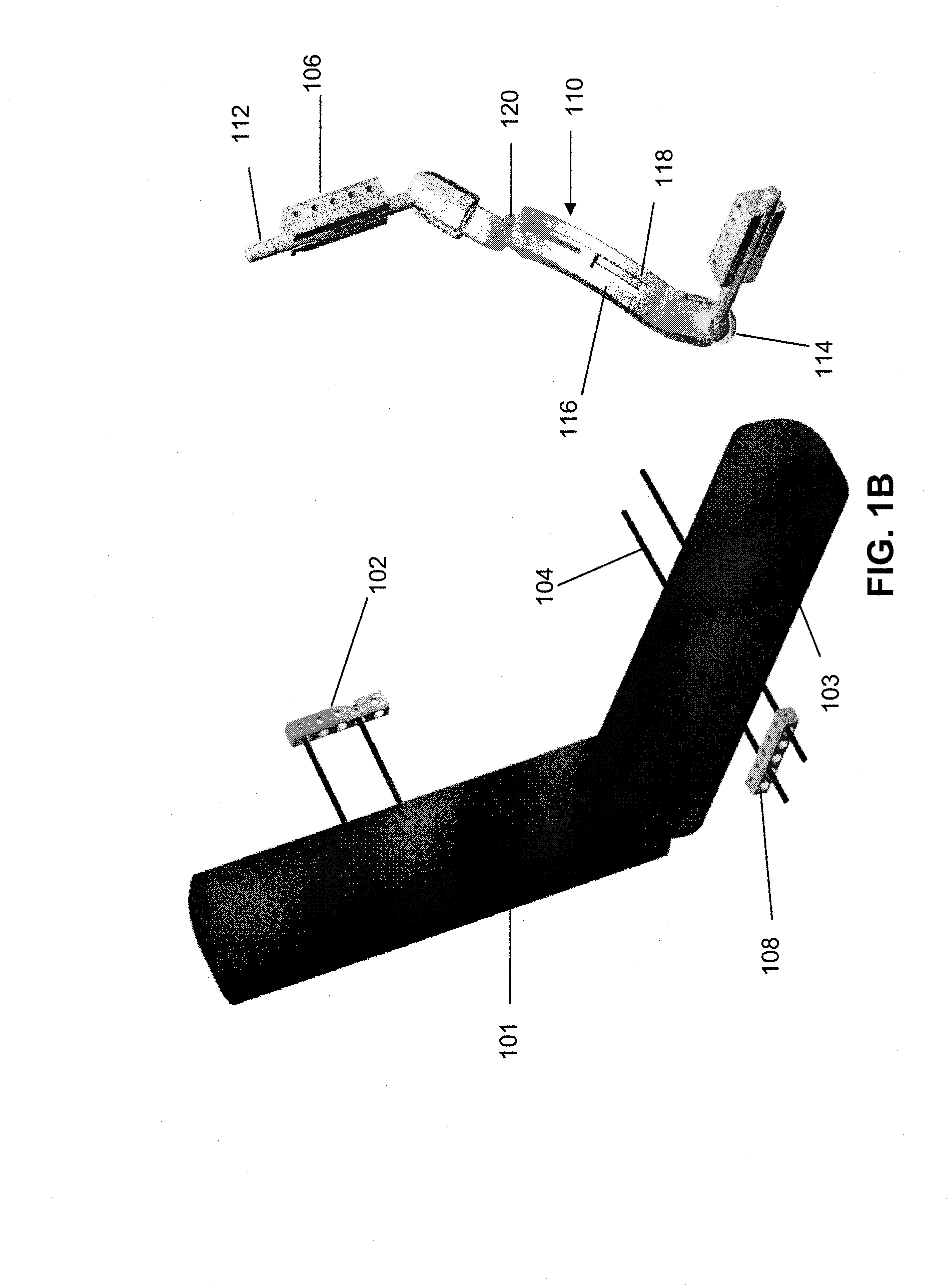 External fixation devices and methods of use