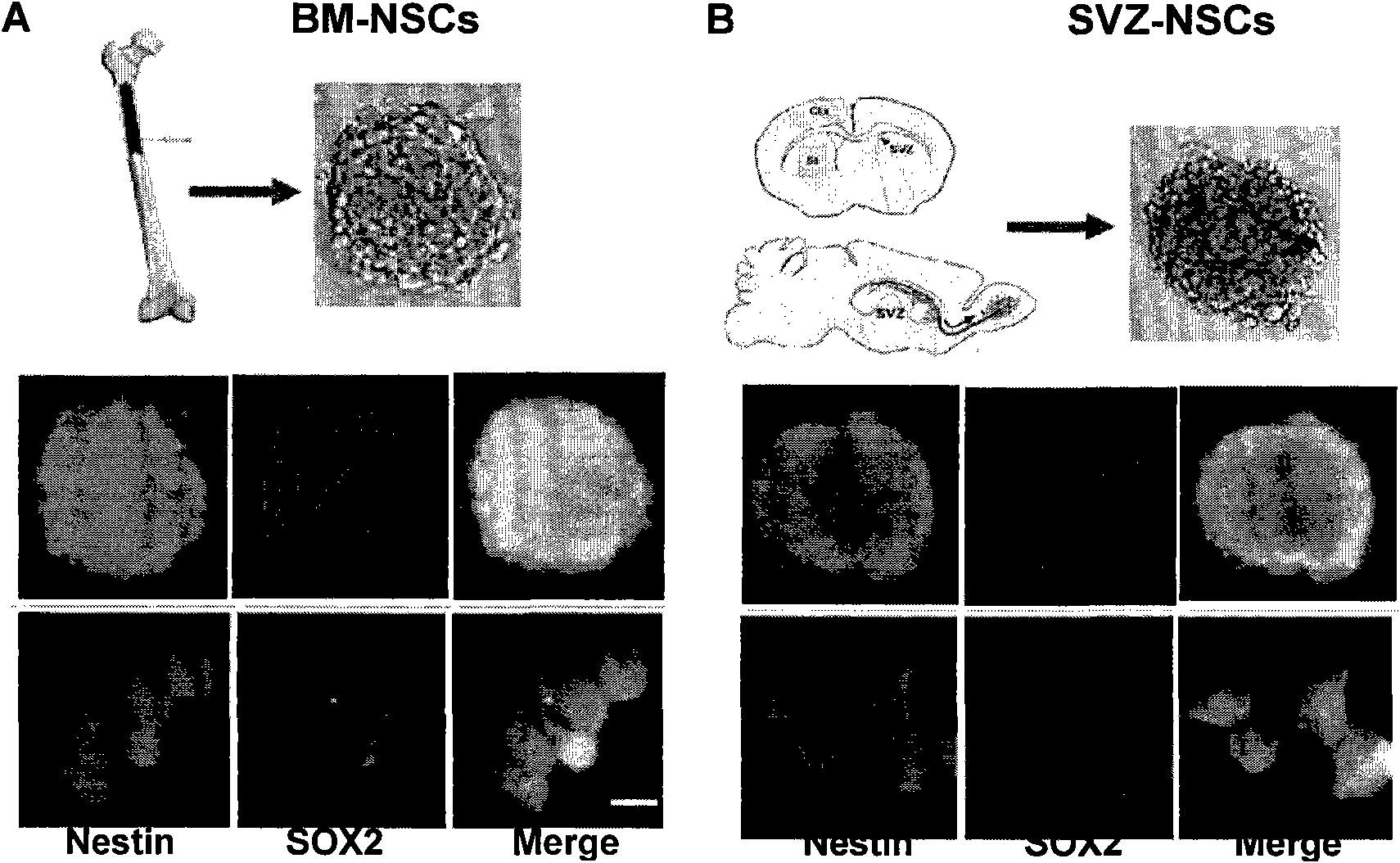 Method for preparing bone marrow-derived neural stem cell for expressing anti-inflammatory cell factor IL-10