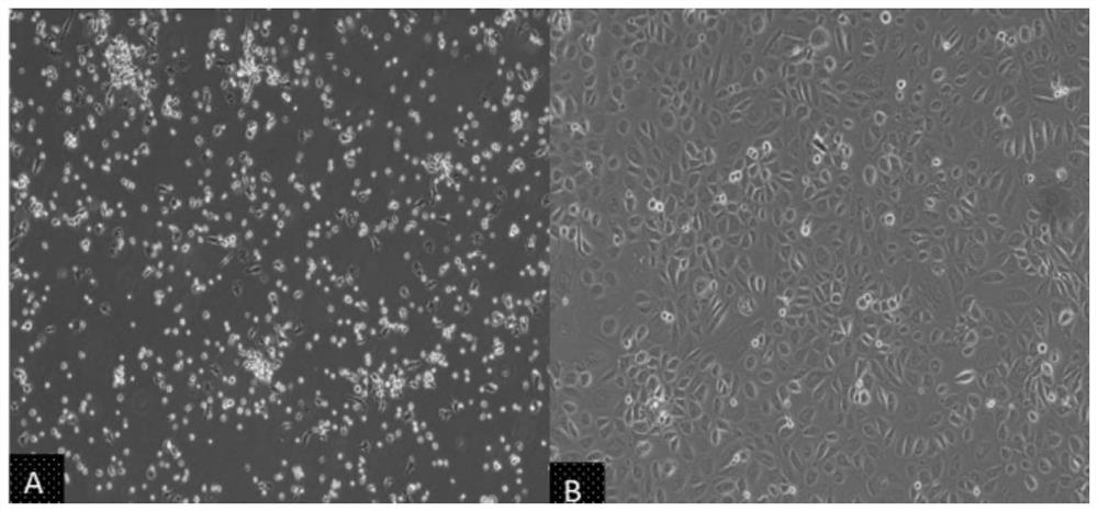 Application of sglt2 inhibitor in the preparation of reagents for inhibiting glucose absorption by pmcs or peritoneal fibrosis