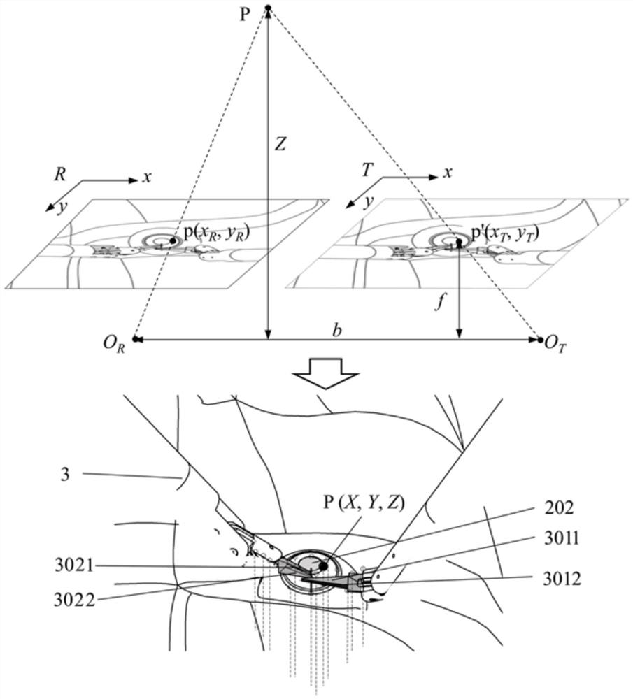 Autonomous stereoscopic vision navigation method and system for corneal transplantation surgical robot