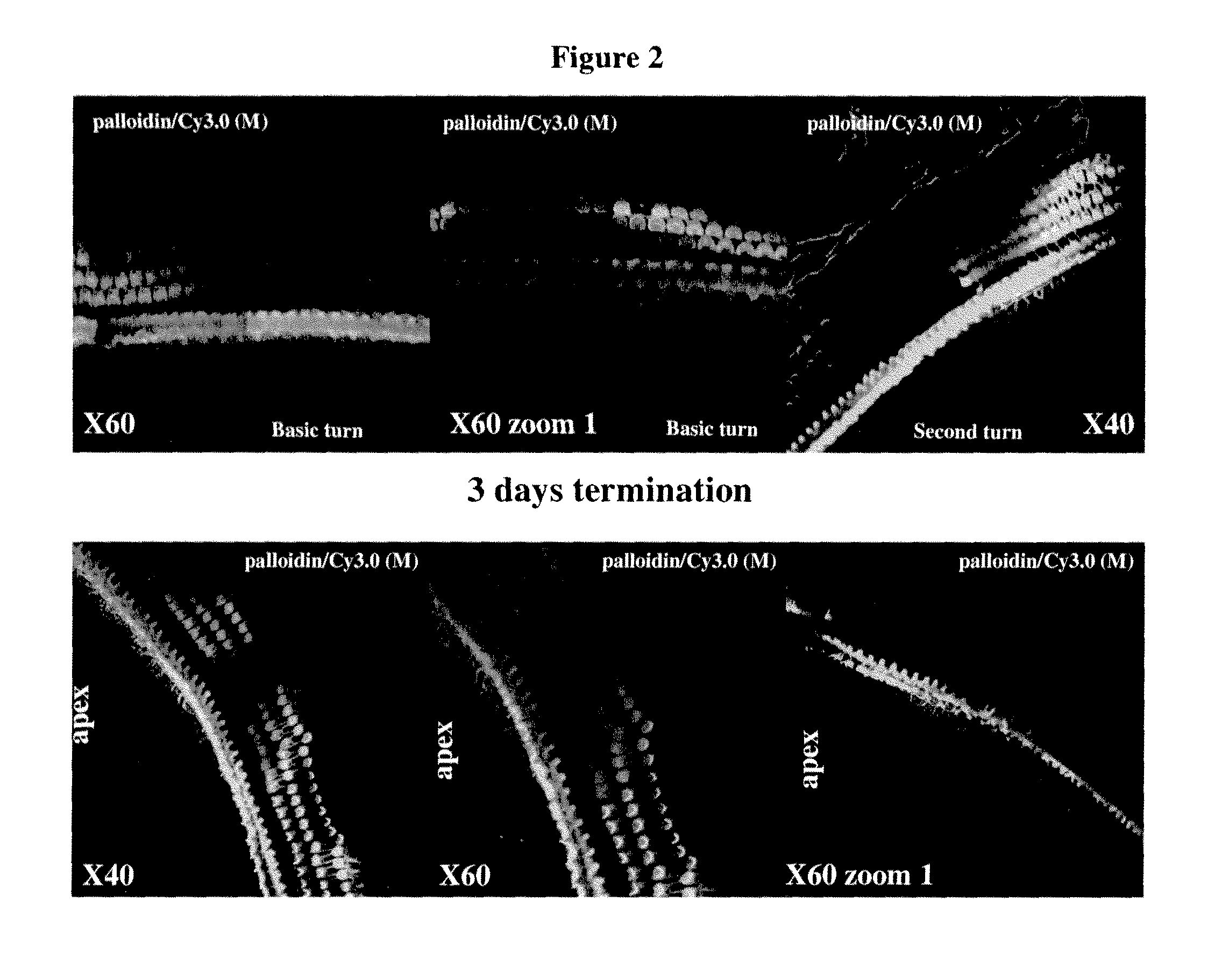 Compositions and methods for treatment of ear disorders