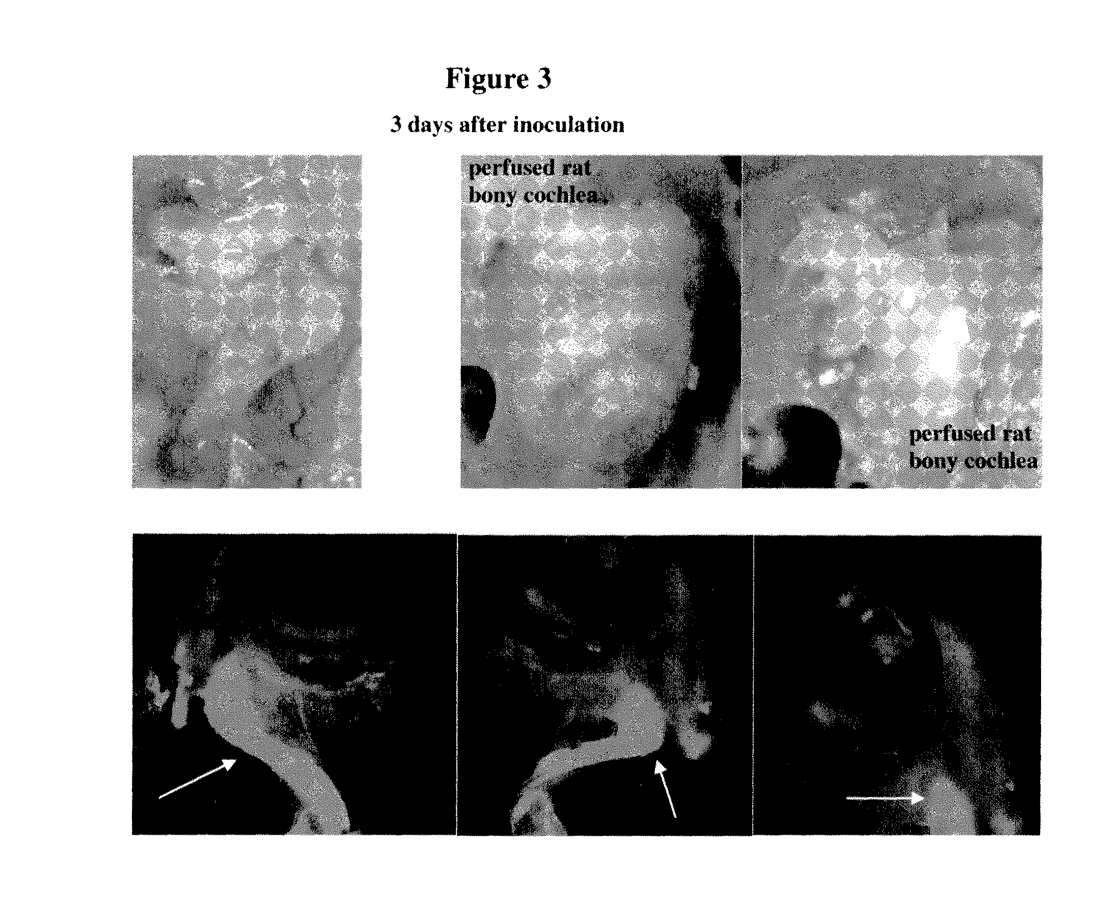 Compositions and methods for treatment of ear disorders