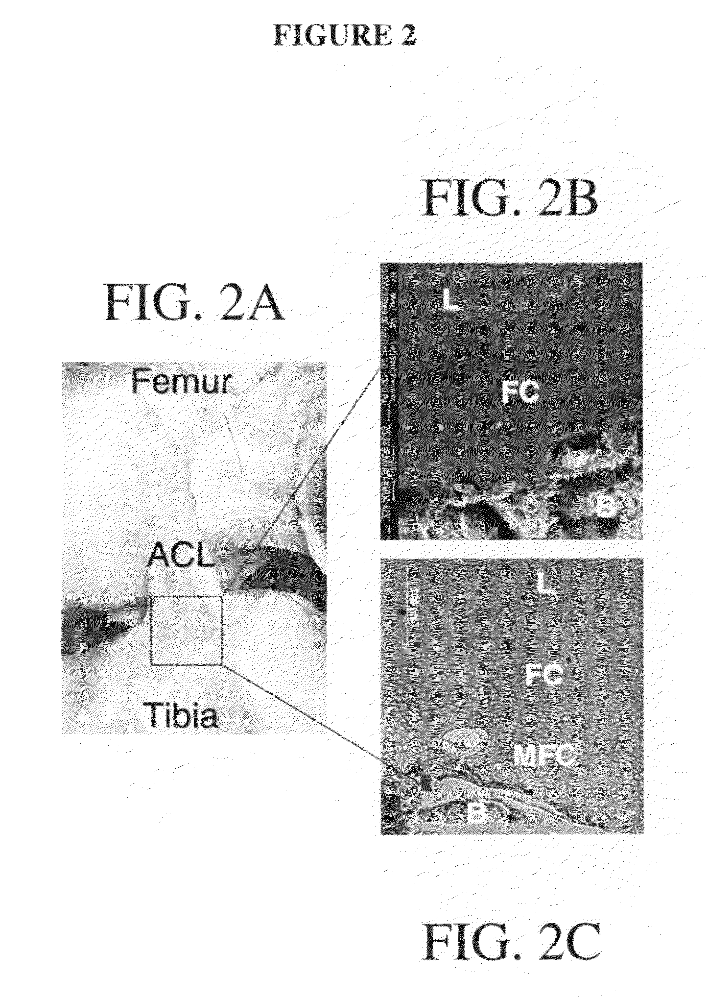 Graft collar and scaffold apparatuses for musculoskeletal tissue engineering and related methods