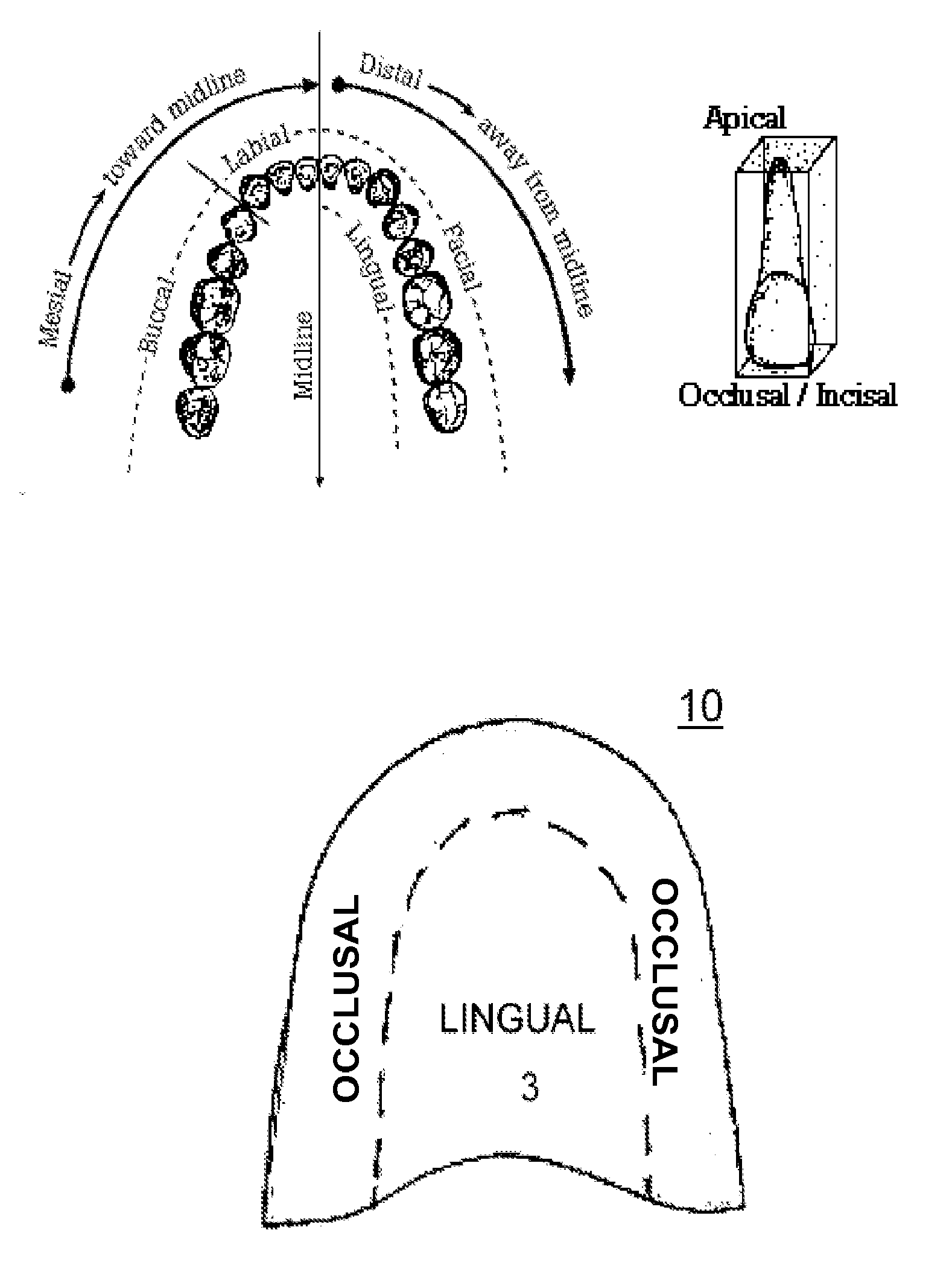Differential Vibratation Of Dental Plate