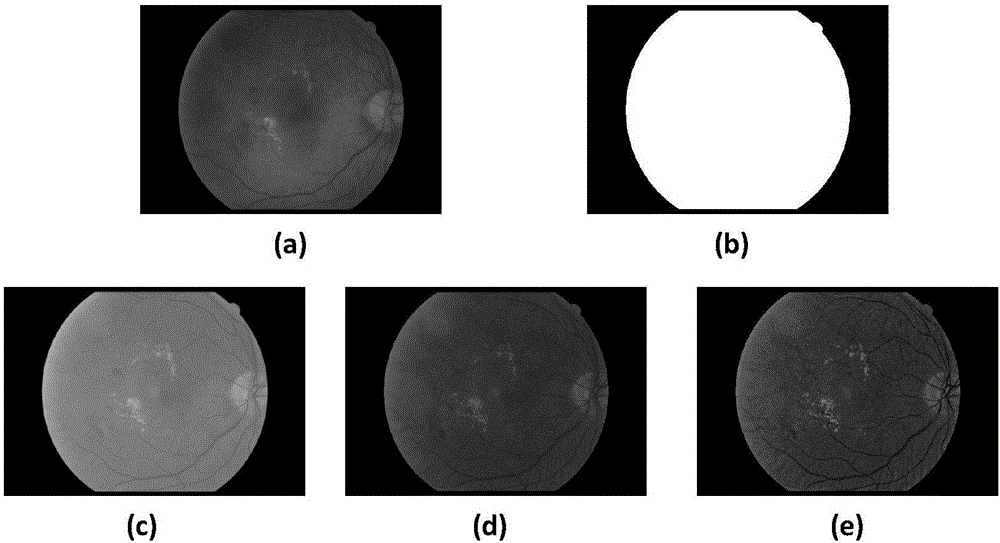 Optic disc segmentation method with combination of fundus image edge information and brightness information
