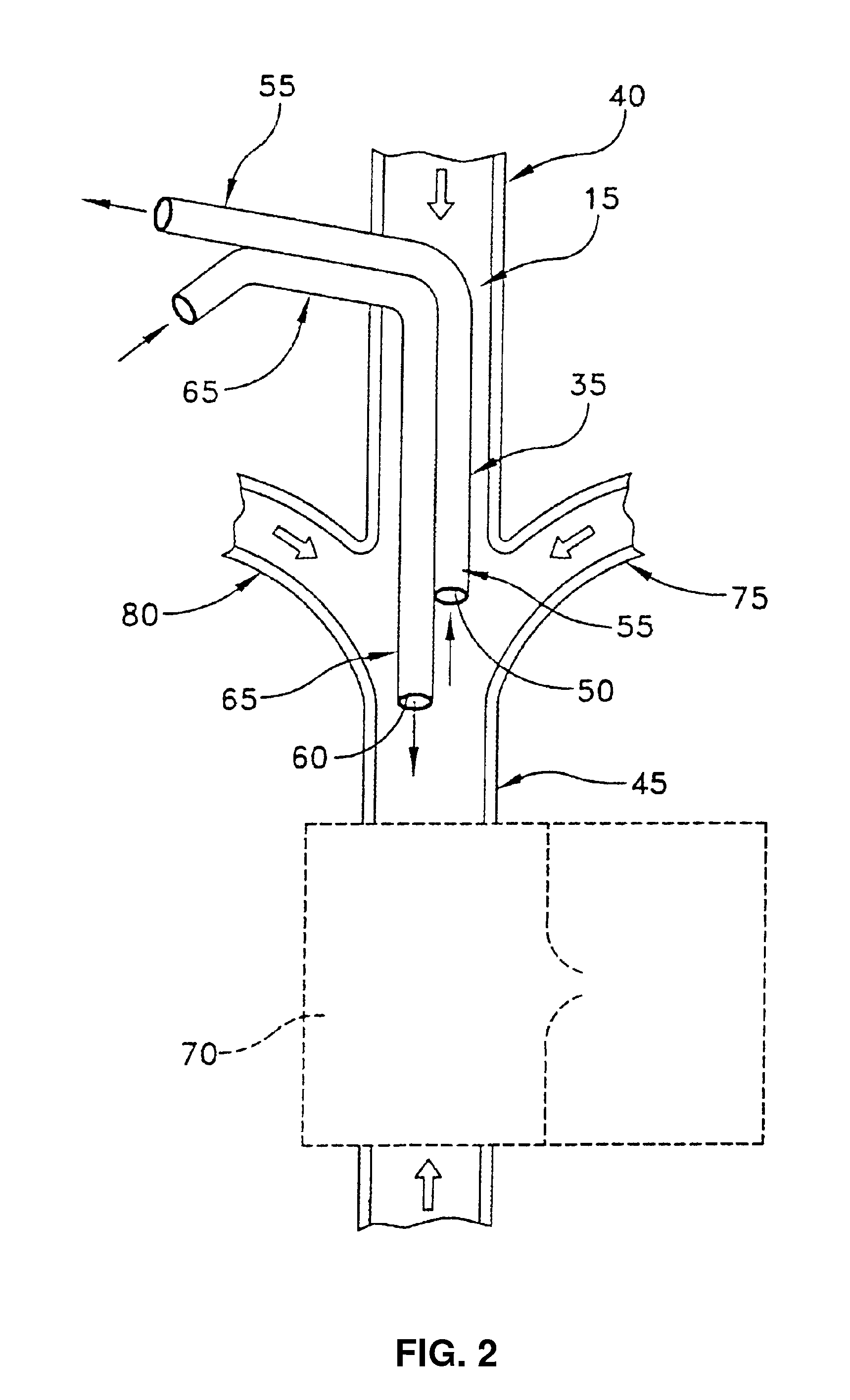 Method and apparatus for the dialysis of blood