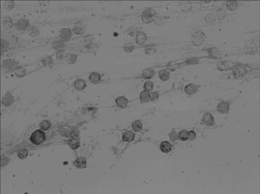 In-situ hybridization detection kit for MICRORNA (MICRO Ribonucleic Acid)-145 level at pathologic evolution early stages of various colon cancers as well as microRNA-145 in-situ hybridization detection method and application of microRNA-145 to preparation of in-situ hybridization detection kit for colon cancers