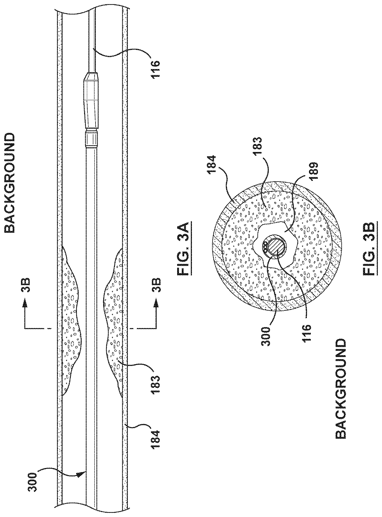 Catheter and method for calculating fractional flow reserve