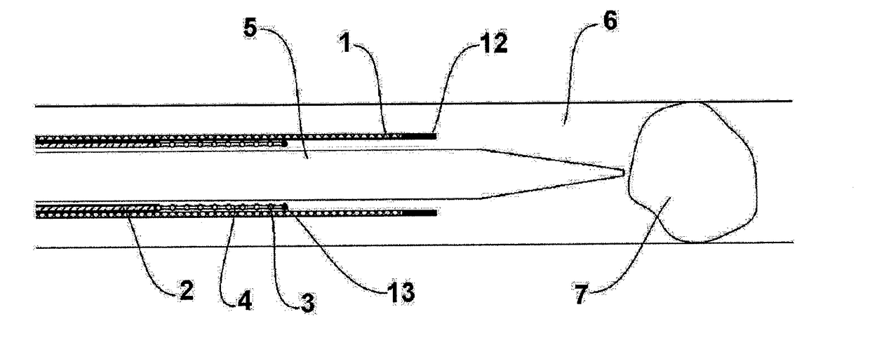 Thrombectomy device, system and method for extraction of vascular thrombi from a blood vessel