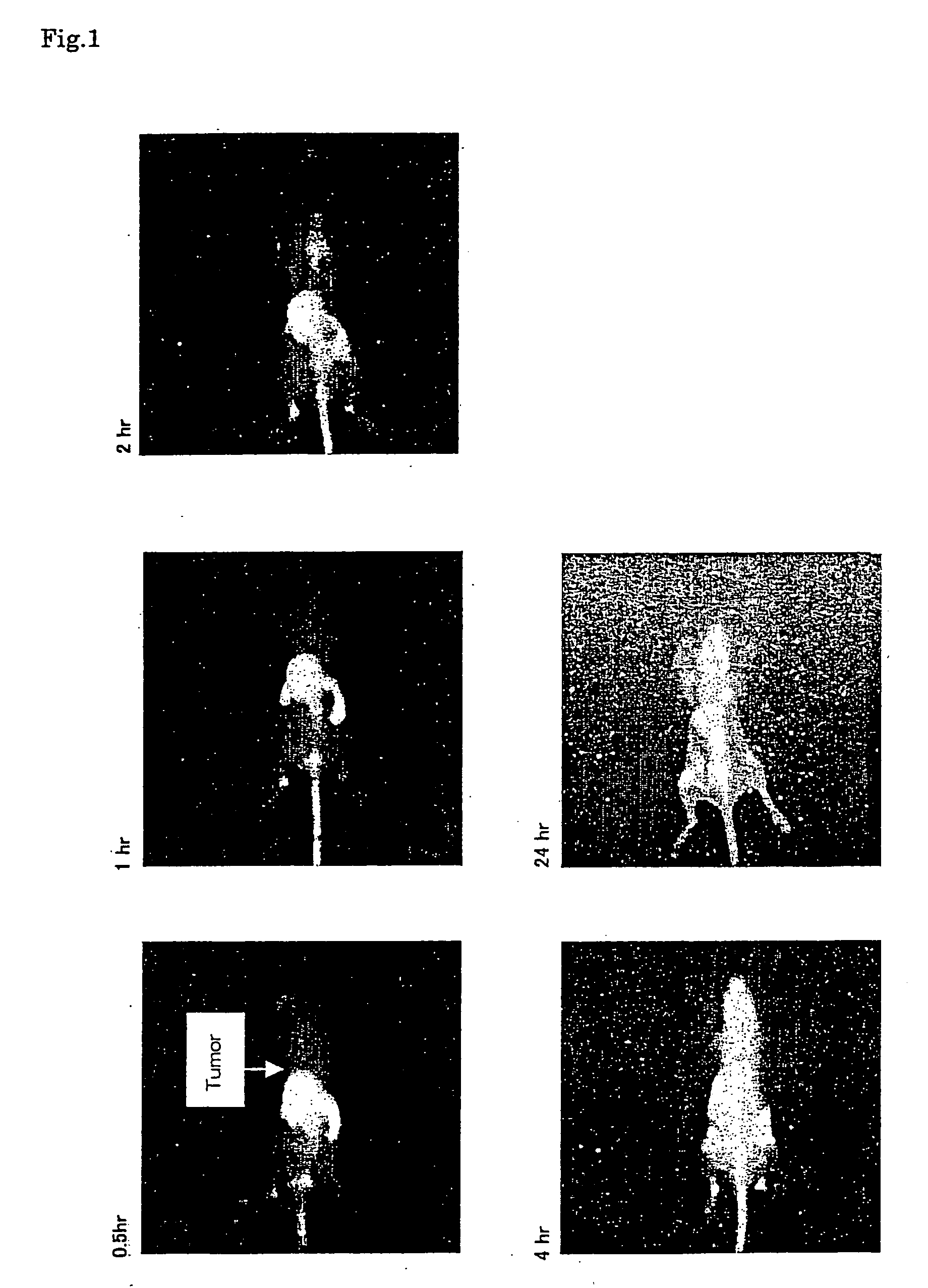 Near infrared fluorescent contrast agent and method for fluorescence imaging