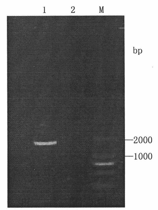 Preparation and application of OCH1 genetic flaw type P. pastoris X-33 bacterial strain