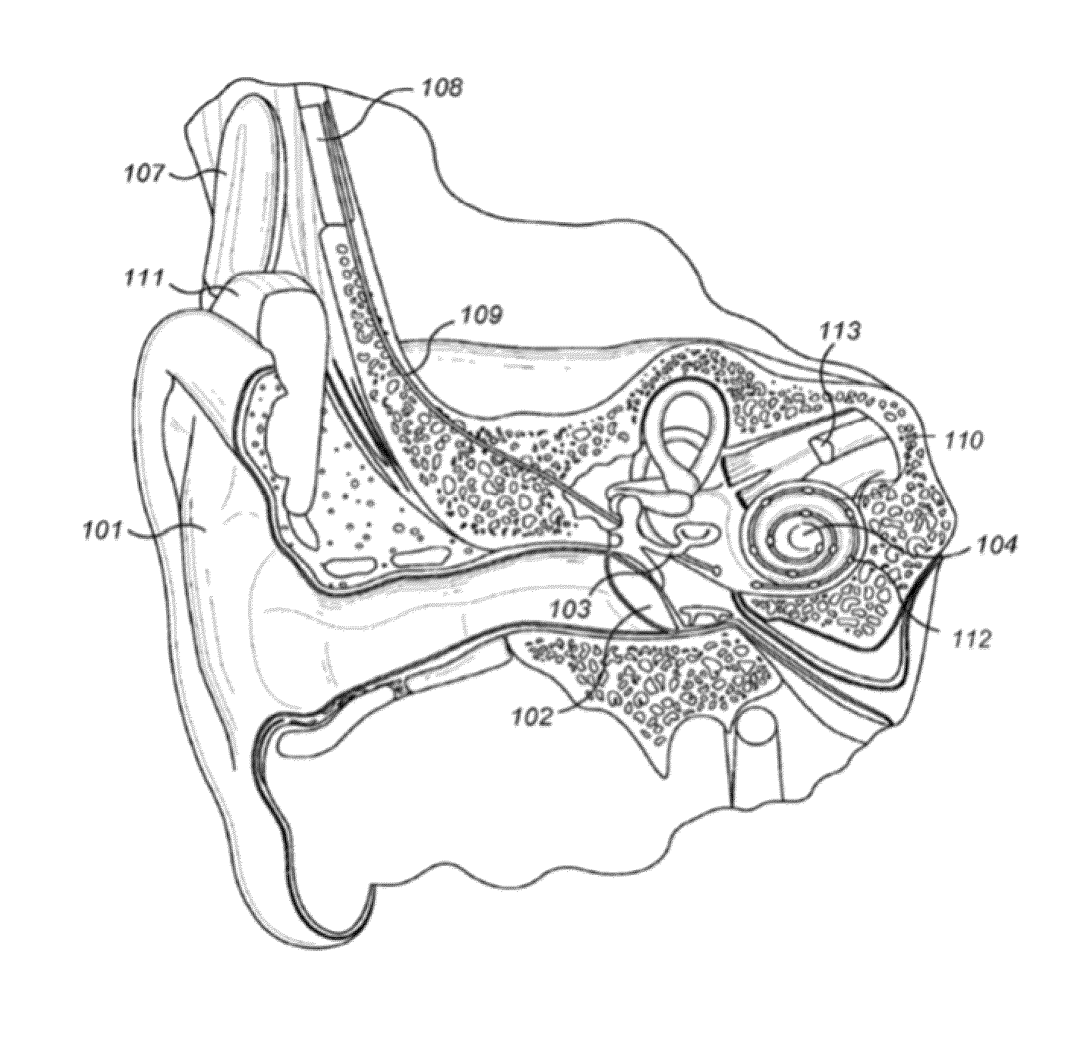 Automatic Selection of Reduction or Enhancement of Transient Sounds