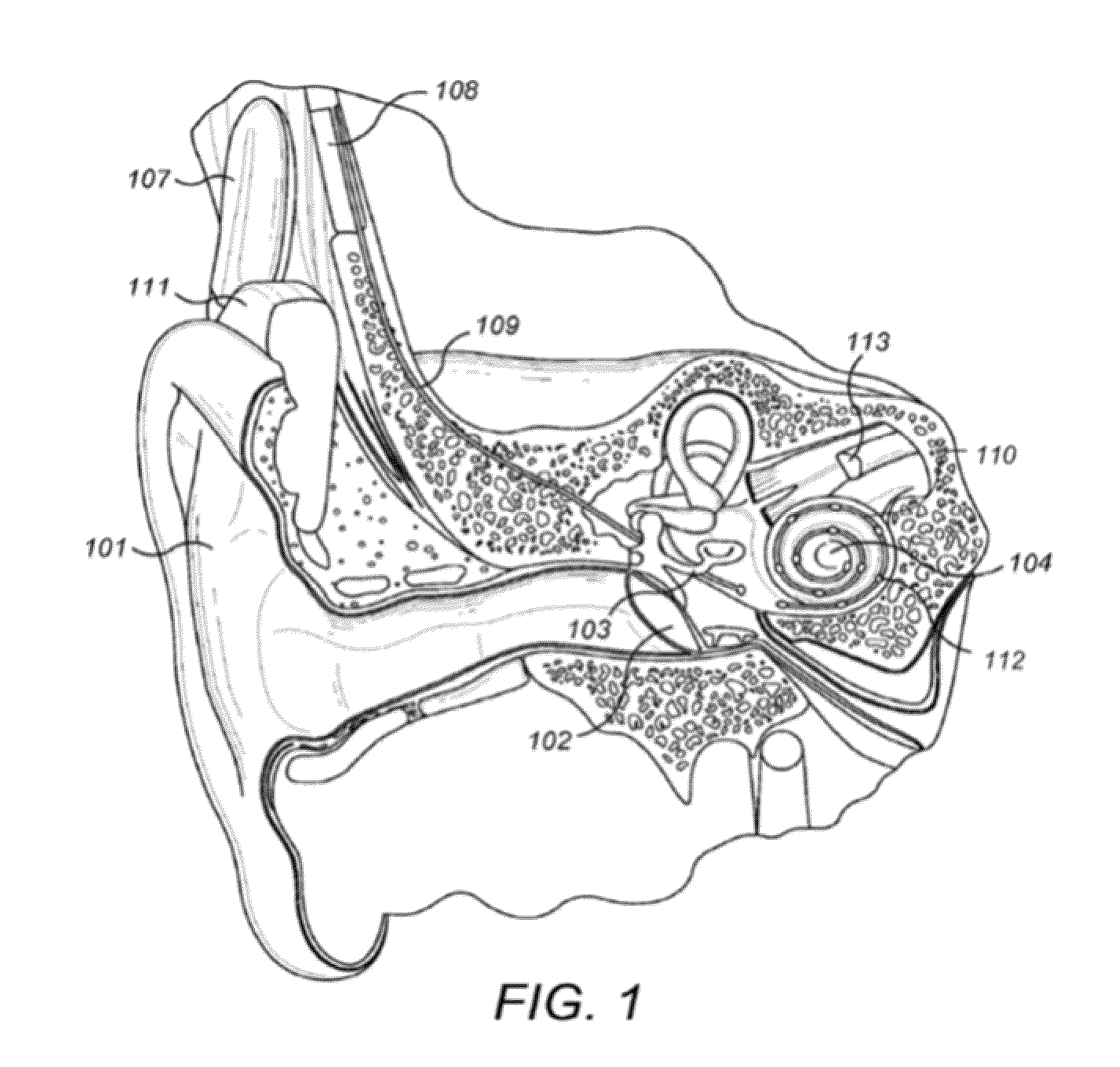 Automatic Selection of Reduction or Enhancement of Transient Sounds