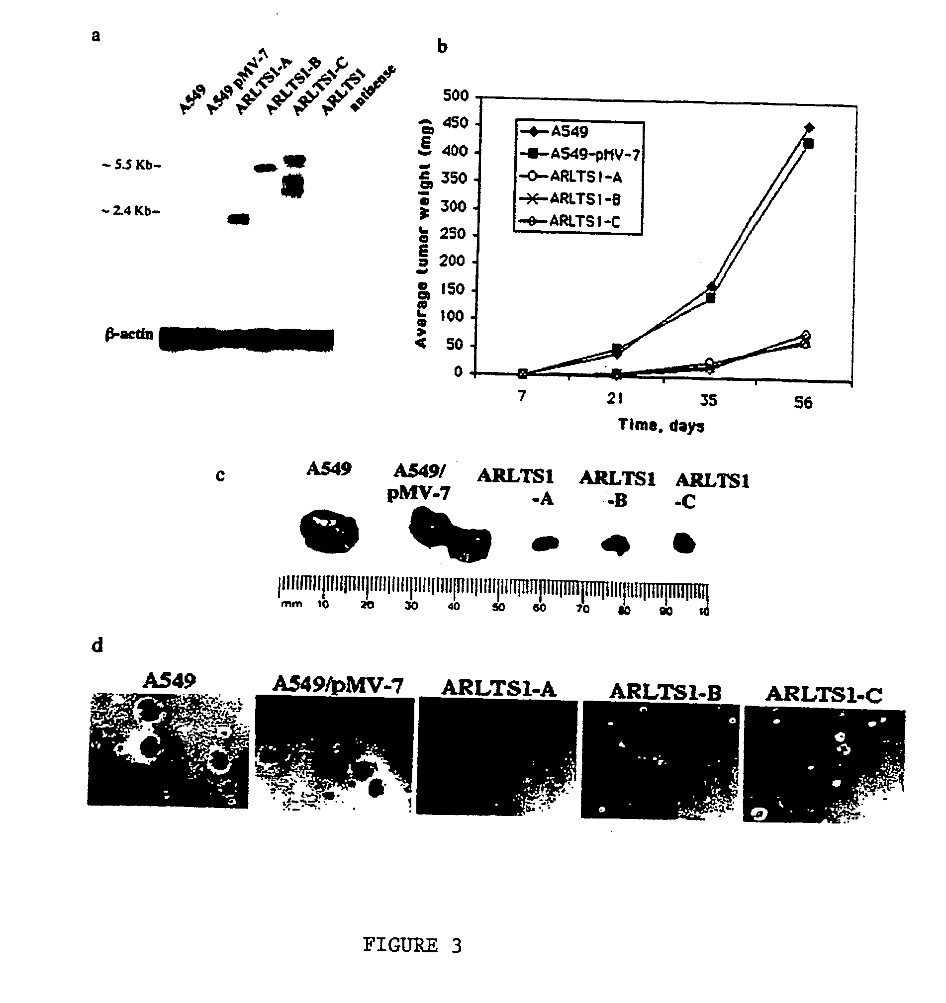 Novel tumor suppressor gene and compositions and methods for making and using the same