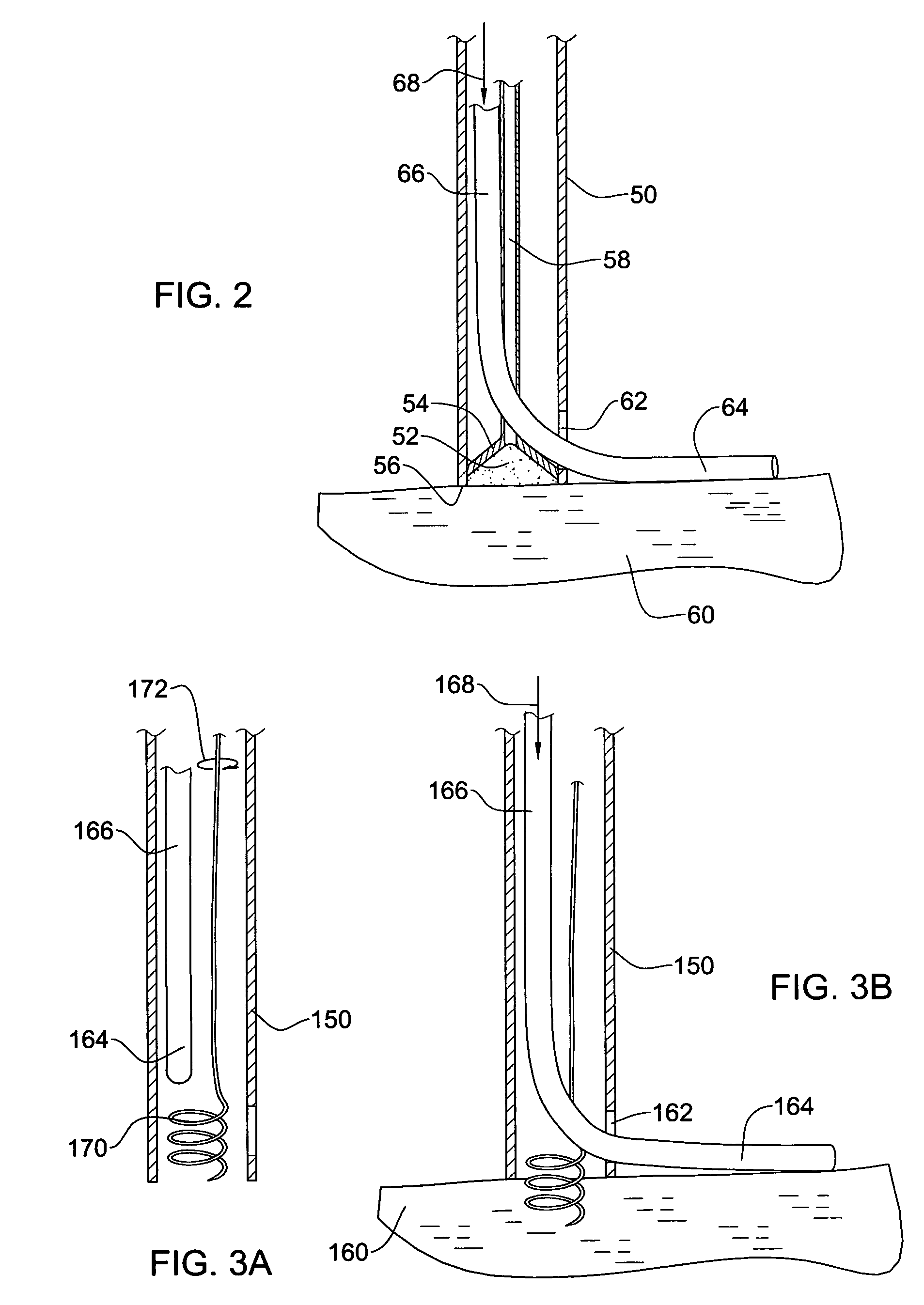 Catheter for delivering a tissue ablation probe