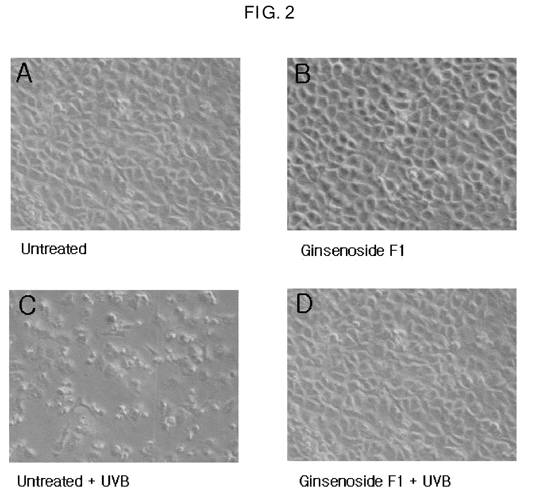 Agent for controlling Bcl-2 expression comprising ginsenoside F1 as an active component