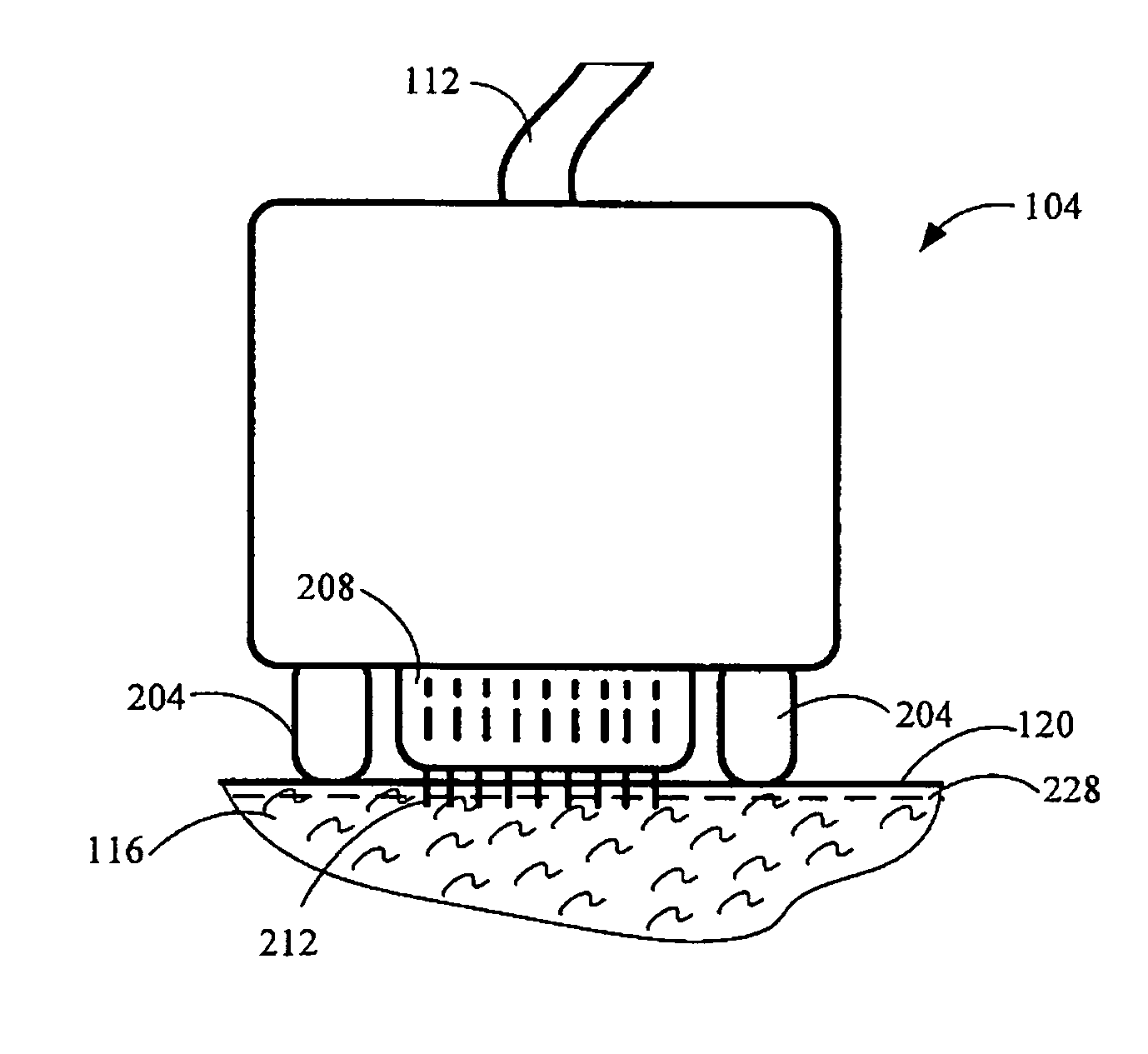 Method and device for collagen growth stimulation