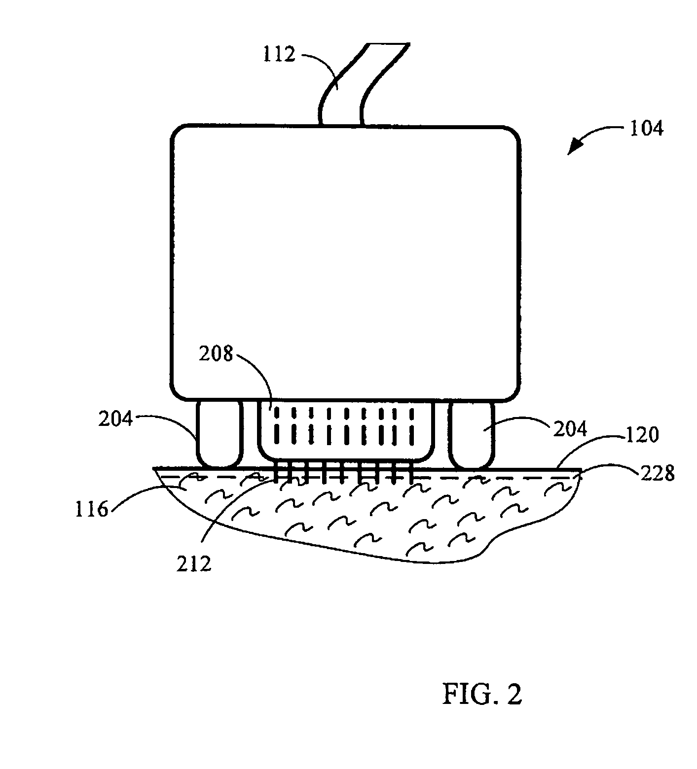 Method and device for collagen growth stimulation