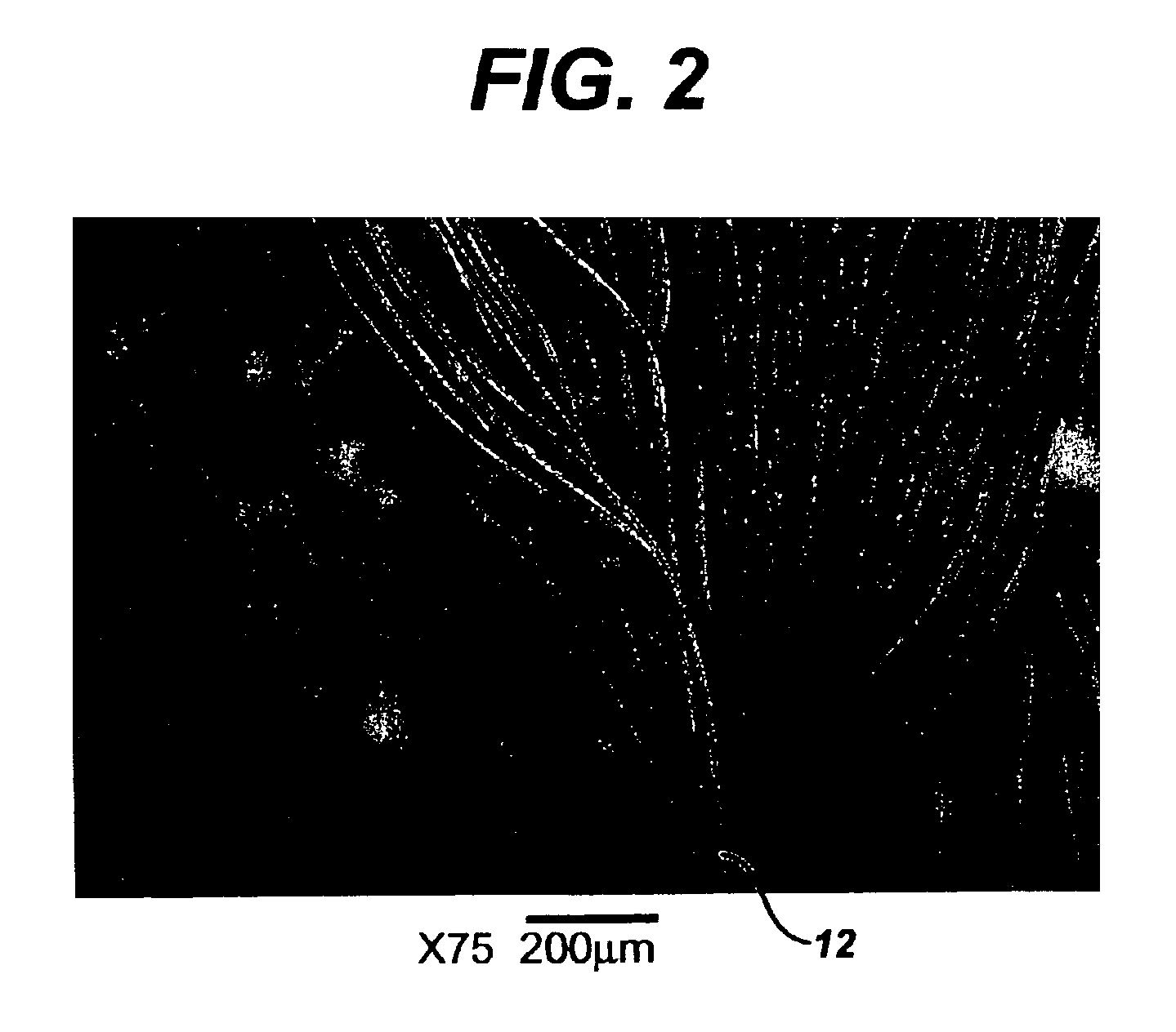 Hemostatic wound dressings and methods of making same
