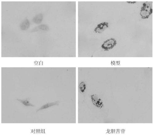 Application of gentiopicroside in preparation of medicines for treating hyperlipidemia