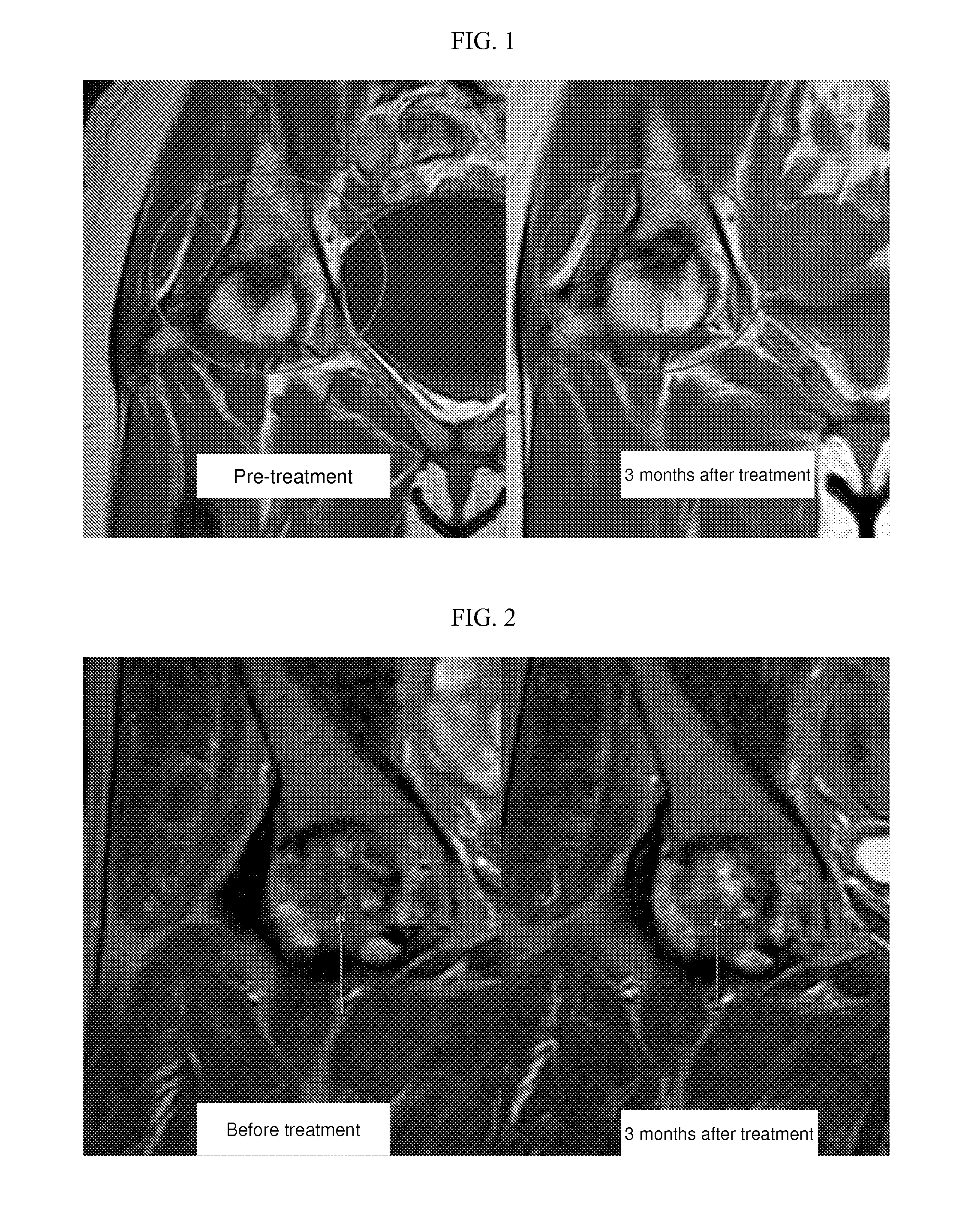 Compositions and methods for treating, preventing, or alleviating bone or cartilage diseases