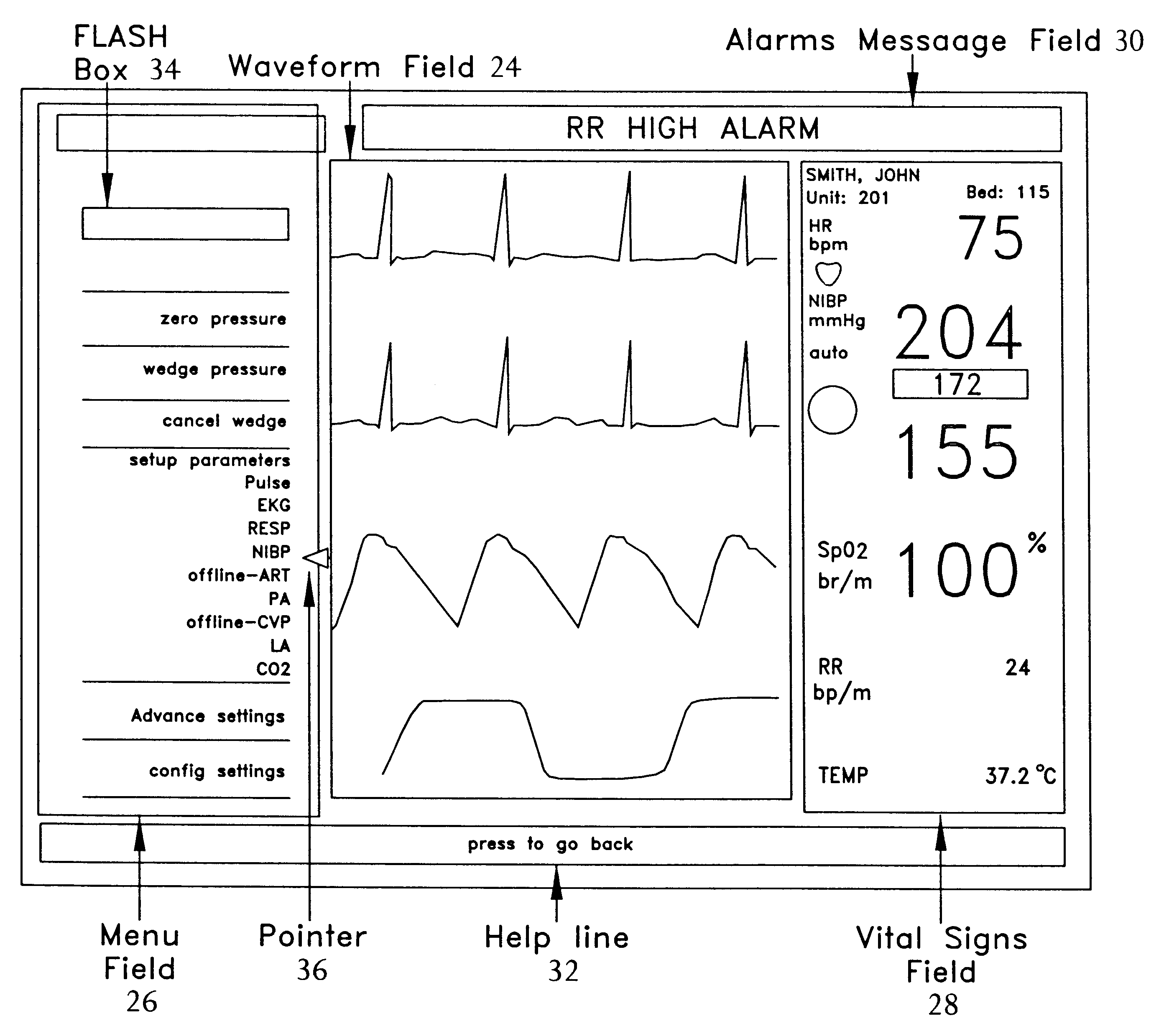 Reconfigurable user interface for modular patient monitor