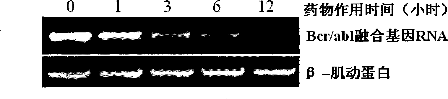 Berbamine derivative and application of salt thereof