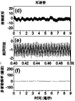 Vocal-cord vibration nondestructive measurement method utilizing natural sound track ultraphonic waveguide effect