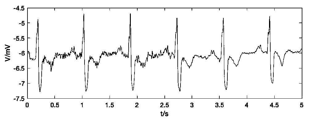 Electrocardiographic signal de-noising method based on adaptive threshold wavelet transform