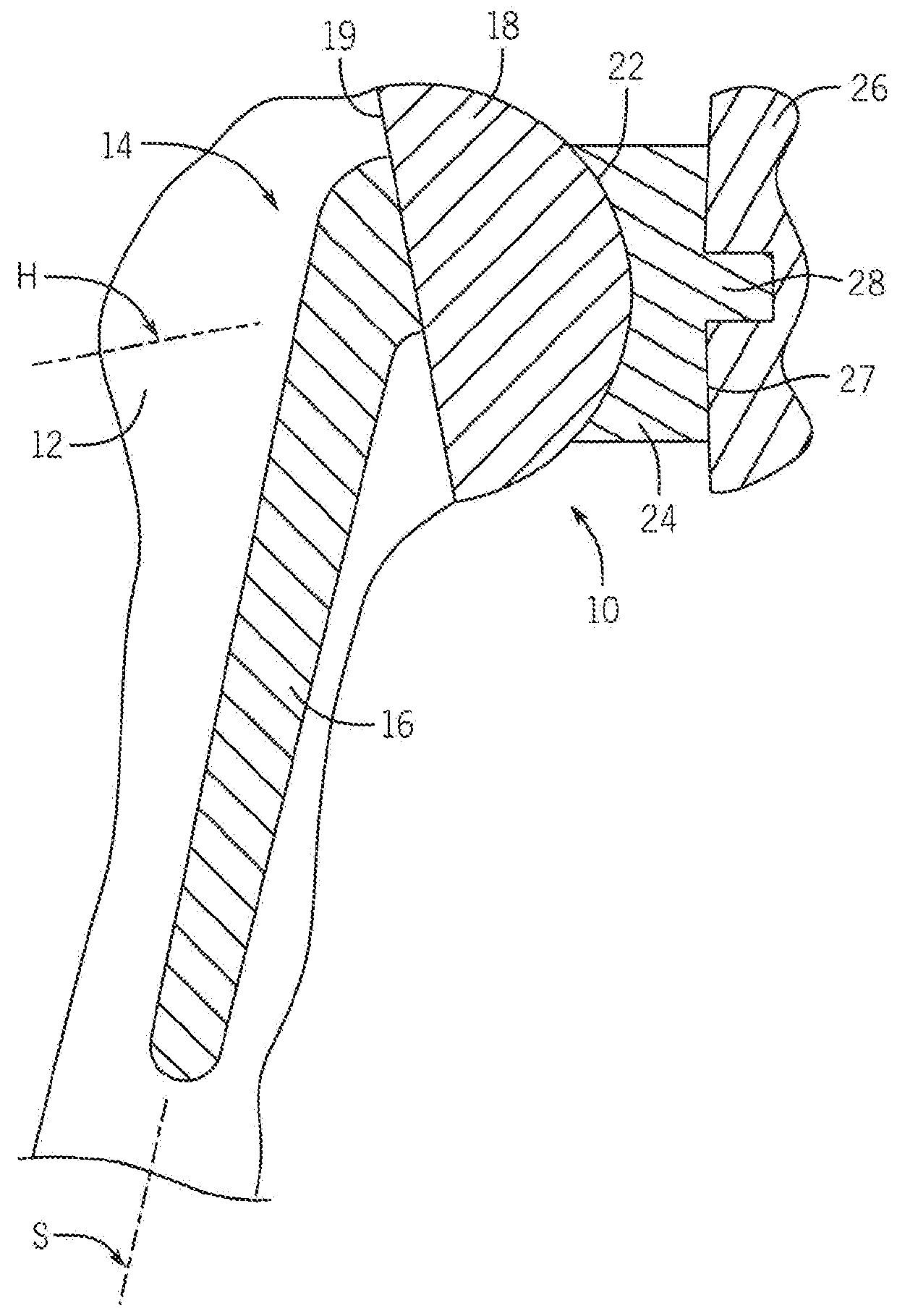 Shoulder Prosthesis With Variable Inclination Humeral Head Component