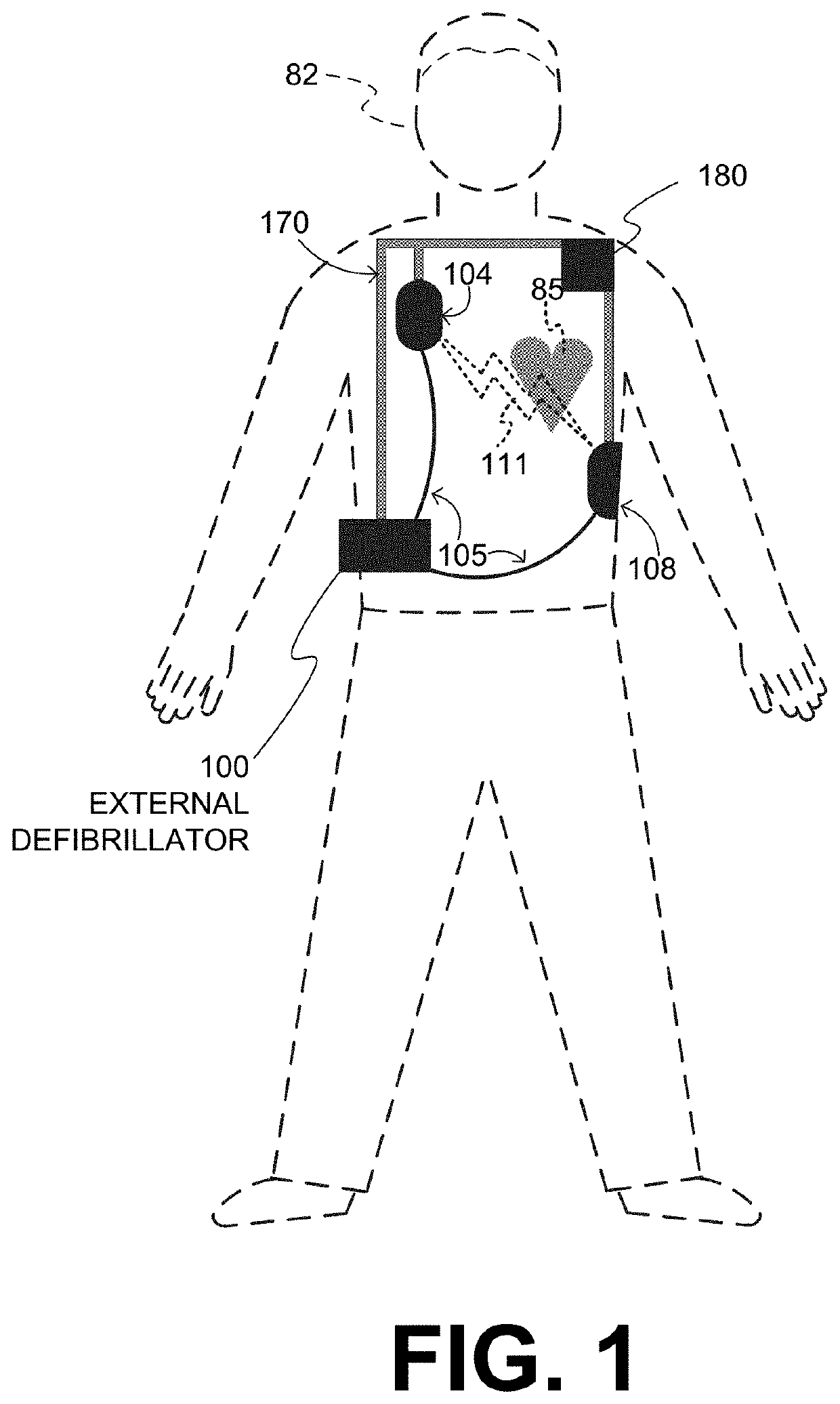 WCD with pacing analgesia