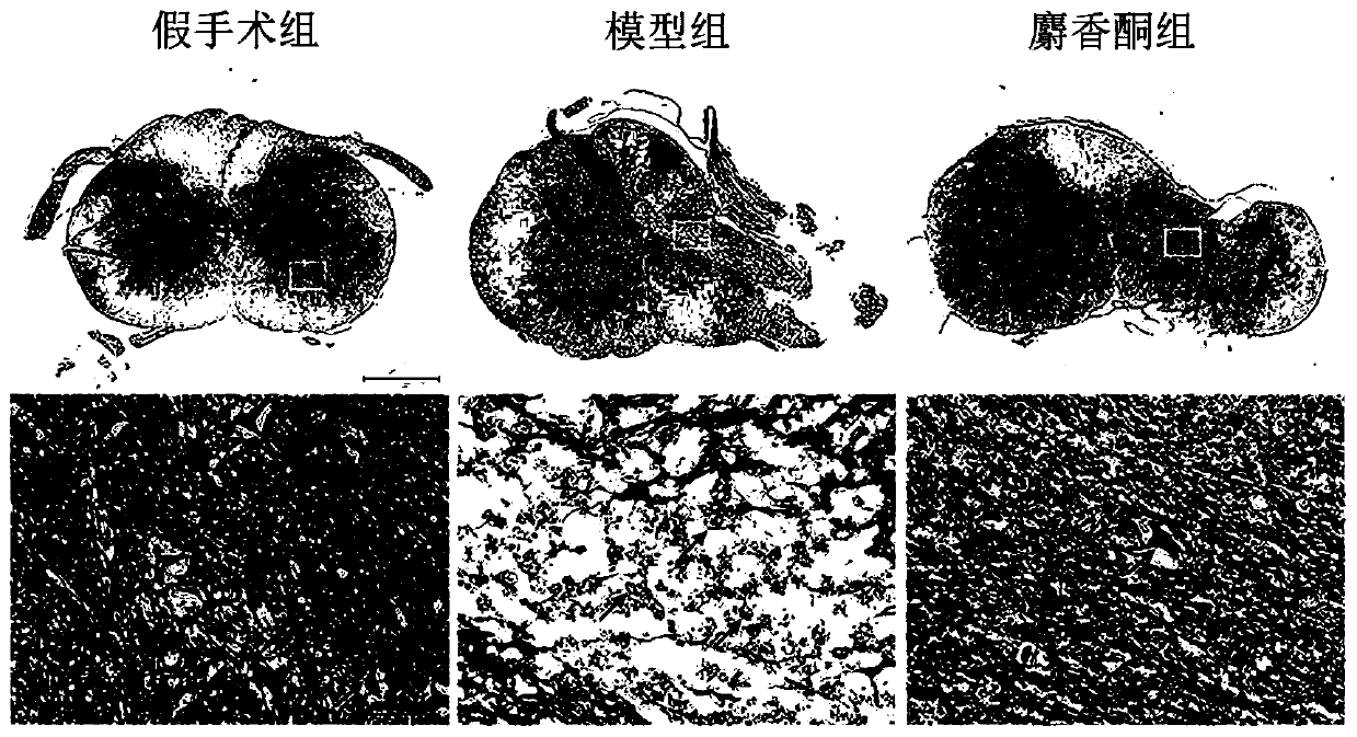 A kind of medicine for preventing and treating cervical spondylotic myelopathy and use thereof