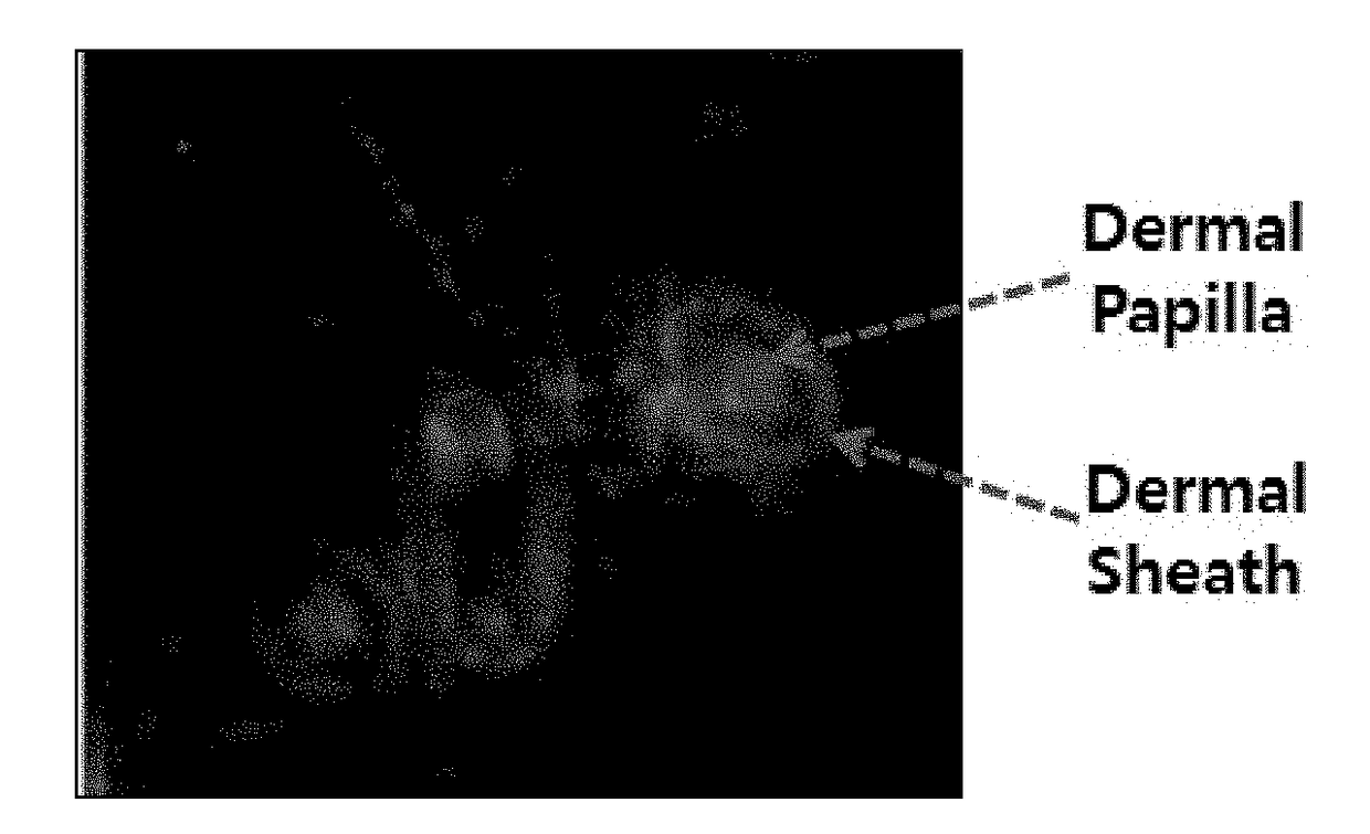 Functional regulatory antibody having actions of promoting proliferation, survival, and cell activation of dermal papilla cells as hair growth regulating center cells and use thereof