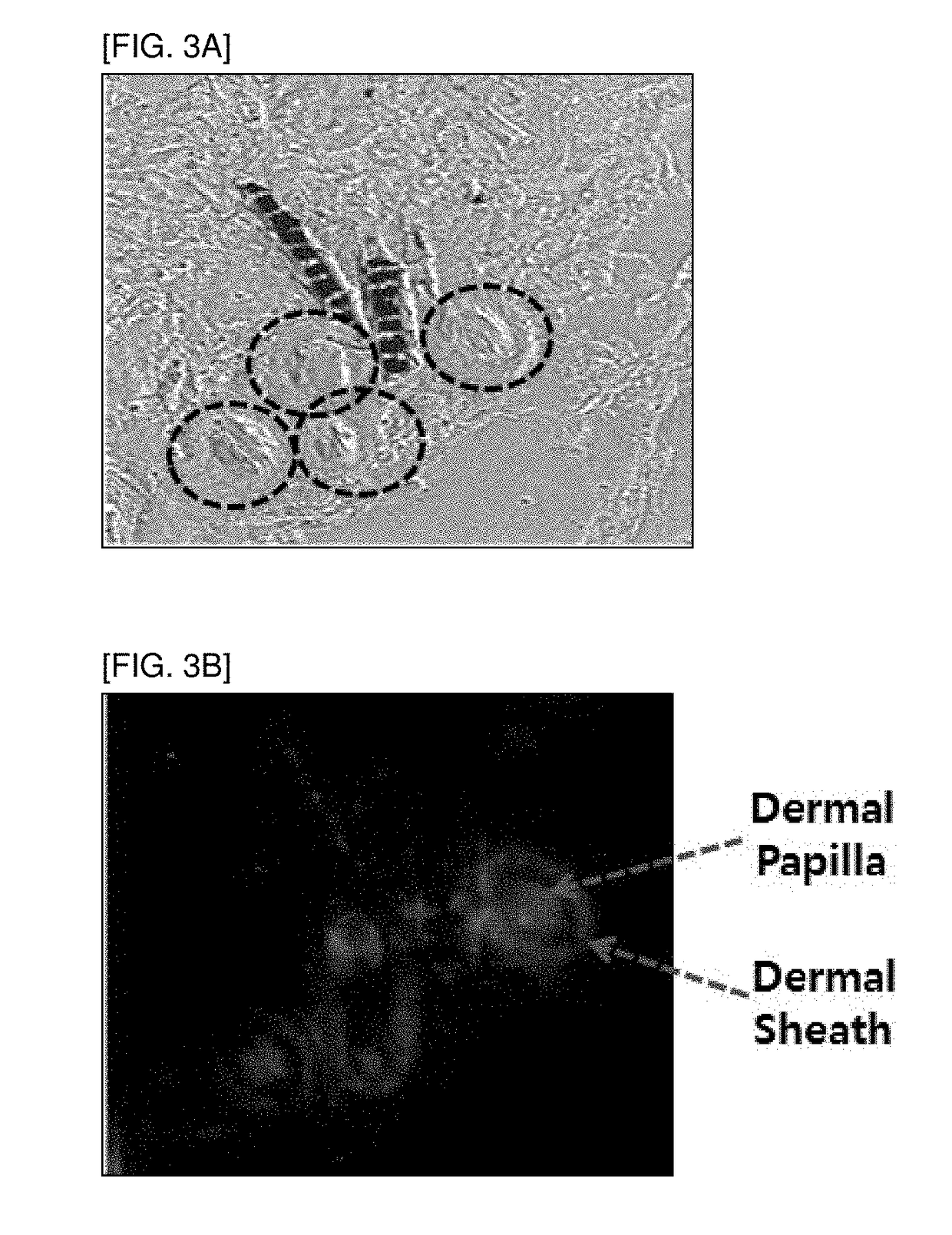 Functional regulatory antibody having actions of promoting proliferation, survival, and cell activation of dermal papilla cells as hair growth regulating center cells and use thereof