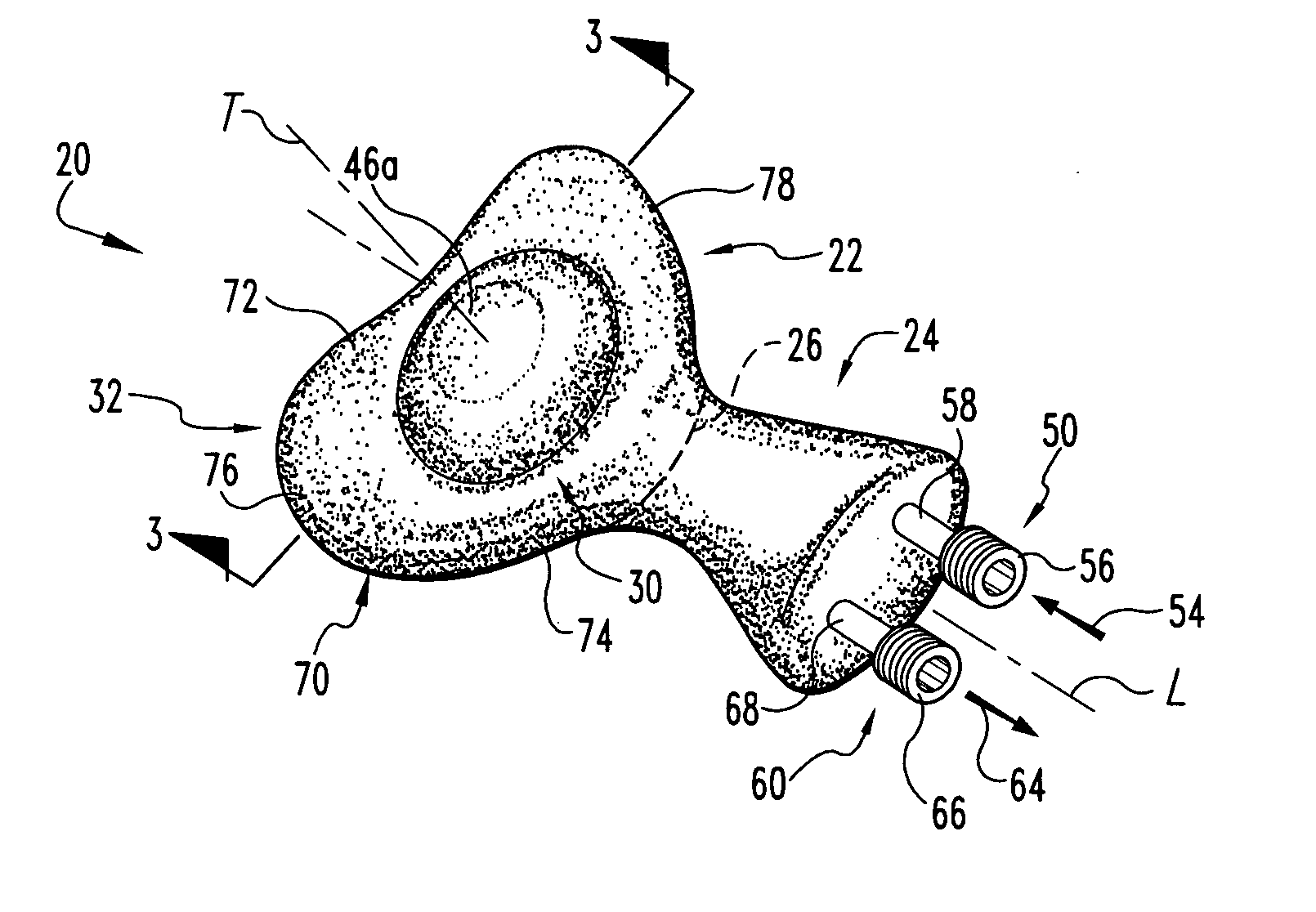Expandable artificial disc and associated methods and instrumentation