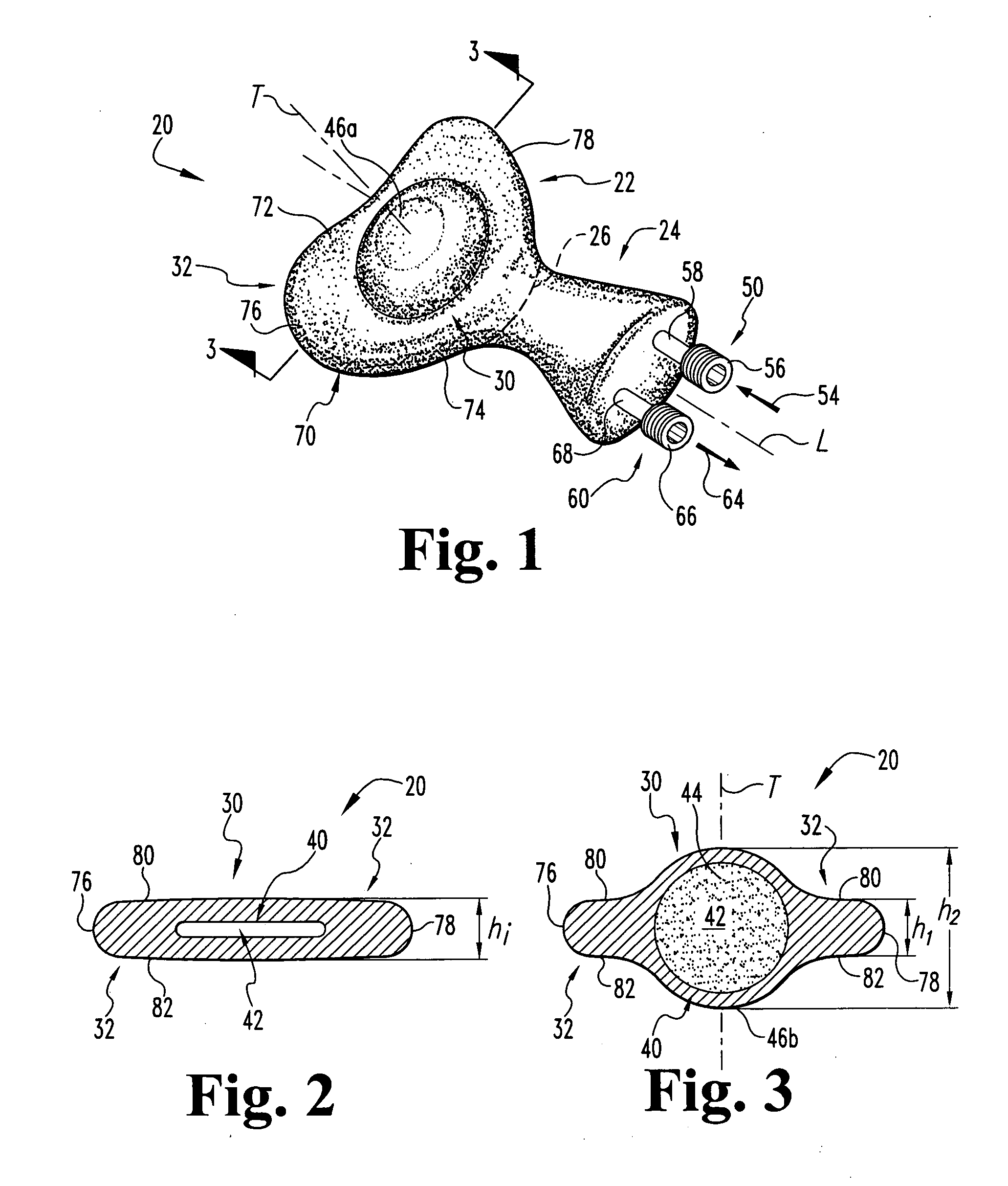 Expandable artificial disc and associated methods and instrumentation