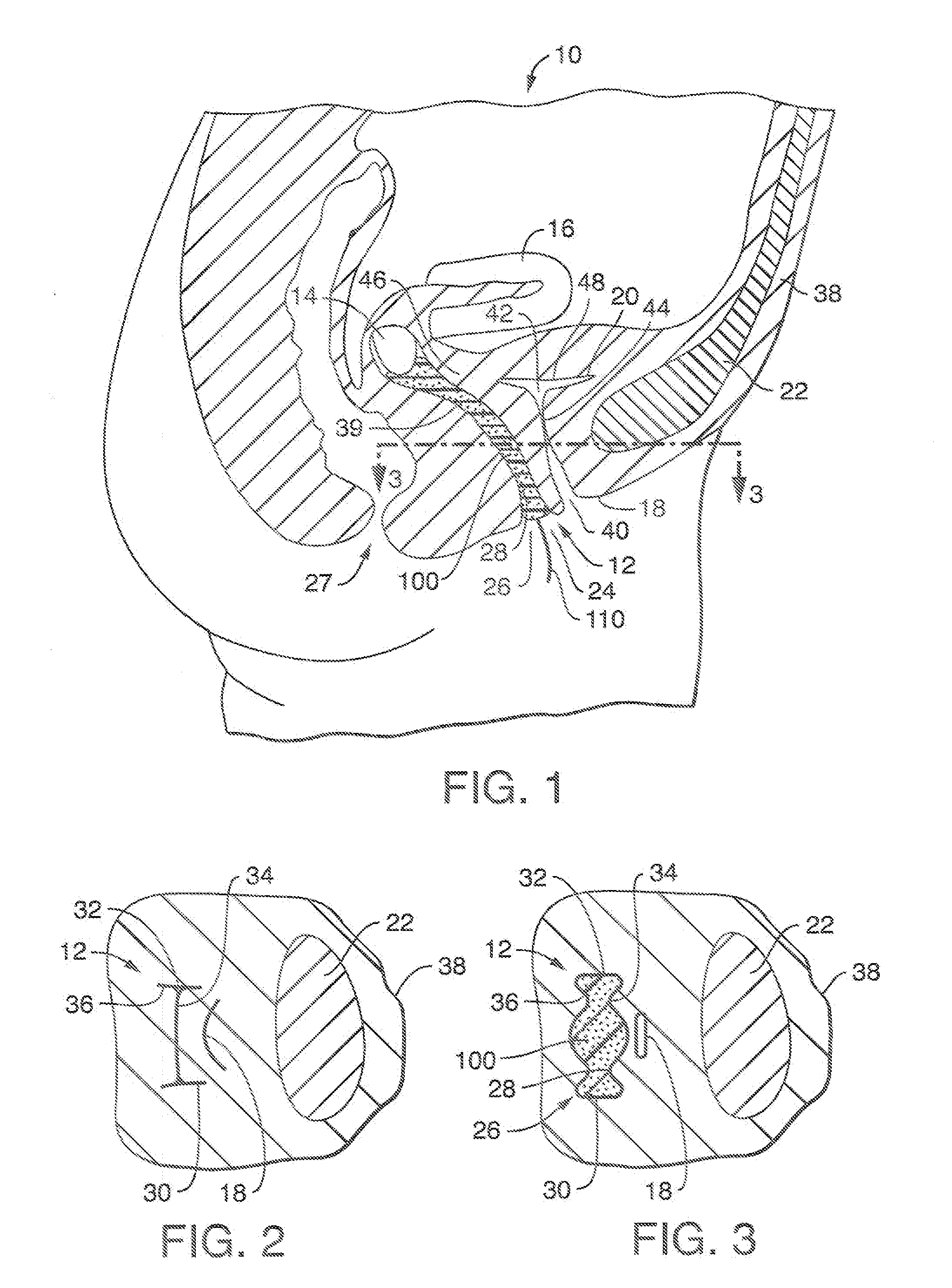 Anatomically Conforming Vaginal Insert