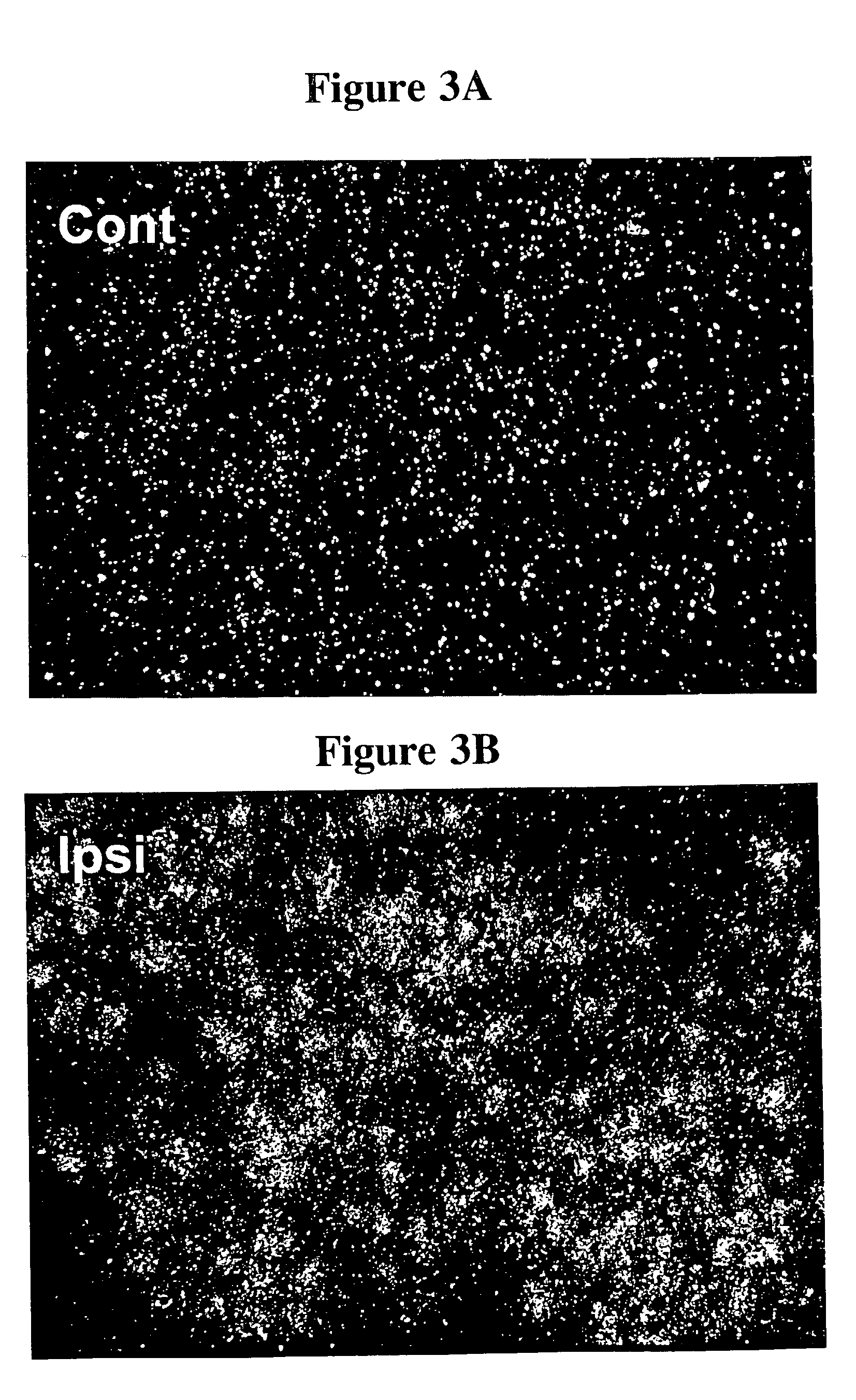 Method of regenerating neurons