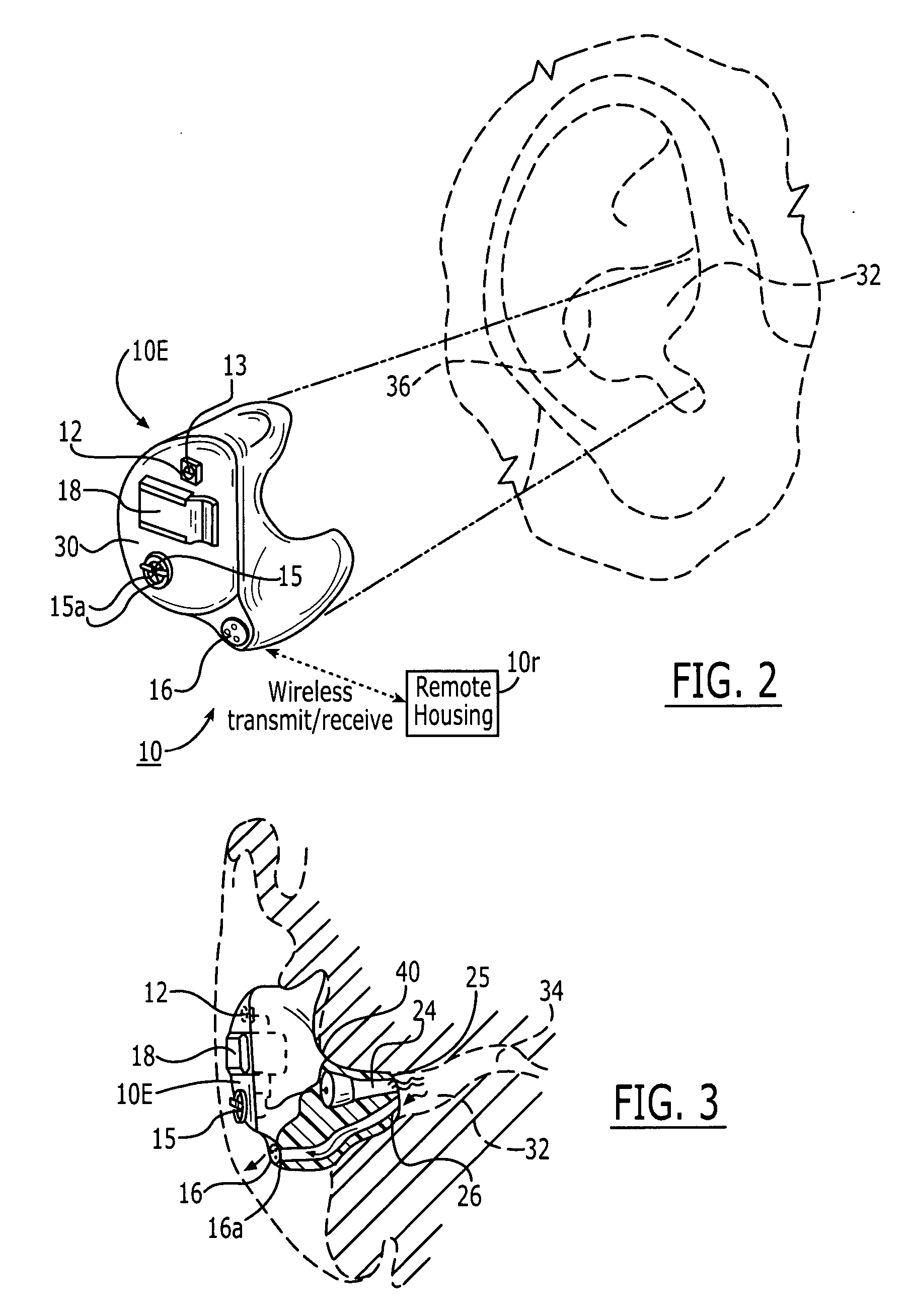 Methods and devices for treating non-stuttering pathologies using frequency altered feedback