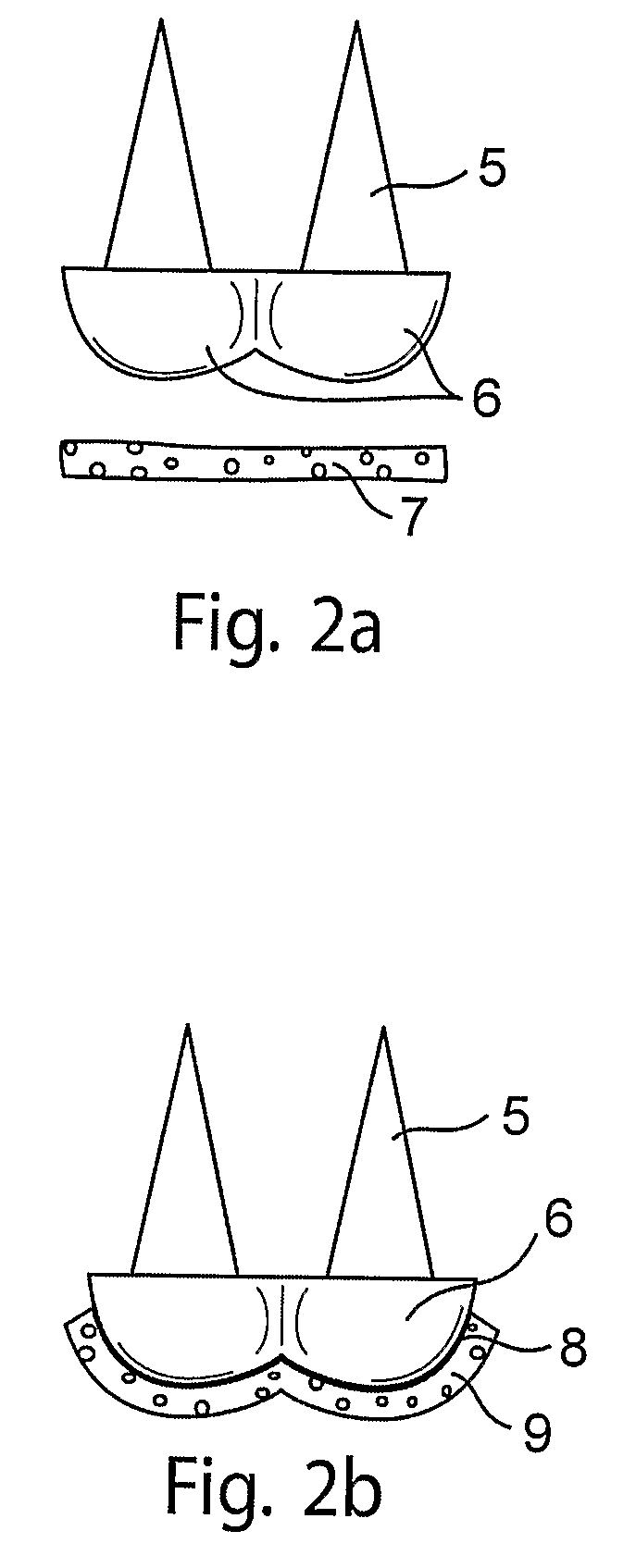 Implants and Methods for Repair, Replacement and Treatment of Disease