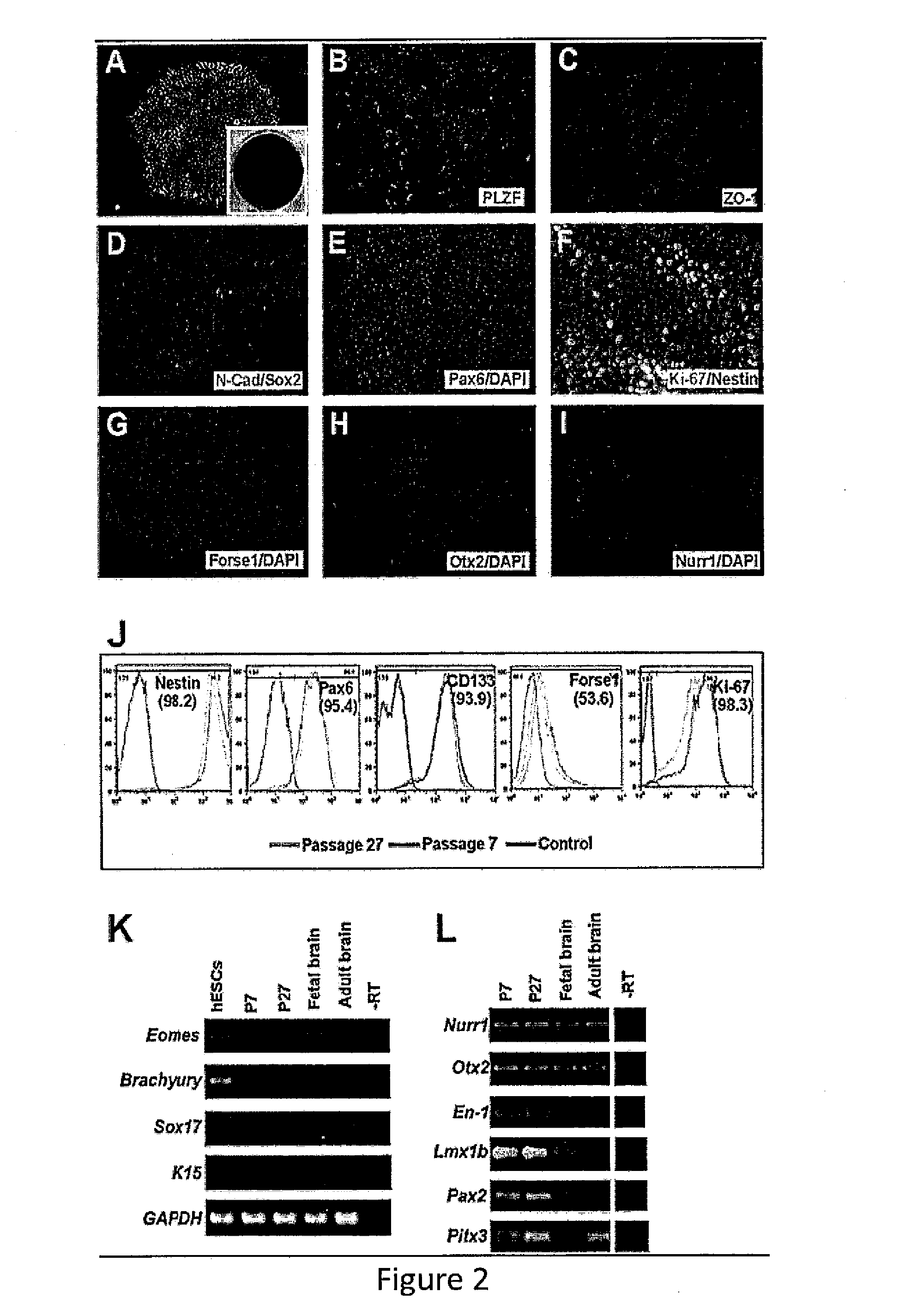 Expandable cell source of neuronal stem cell populations and methods for obtaining and using them