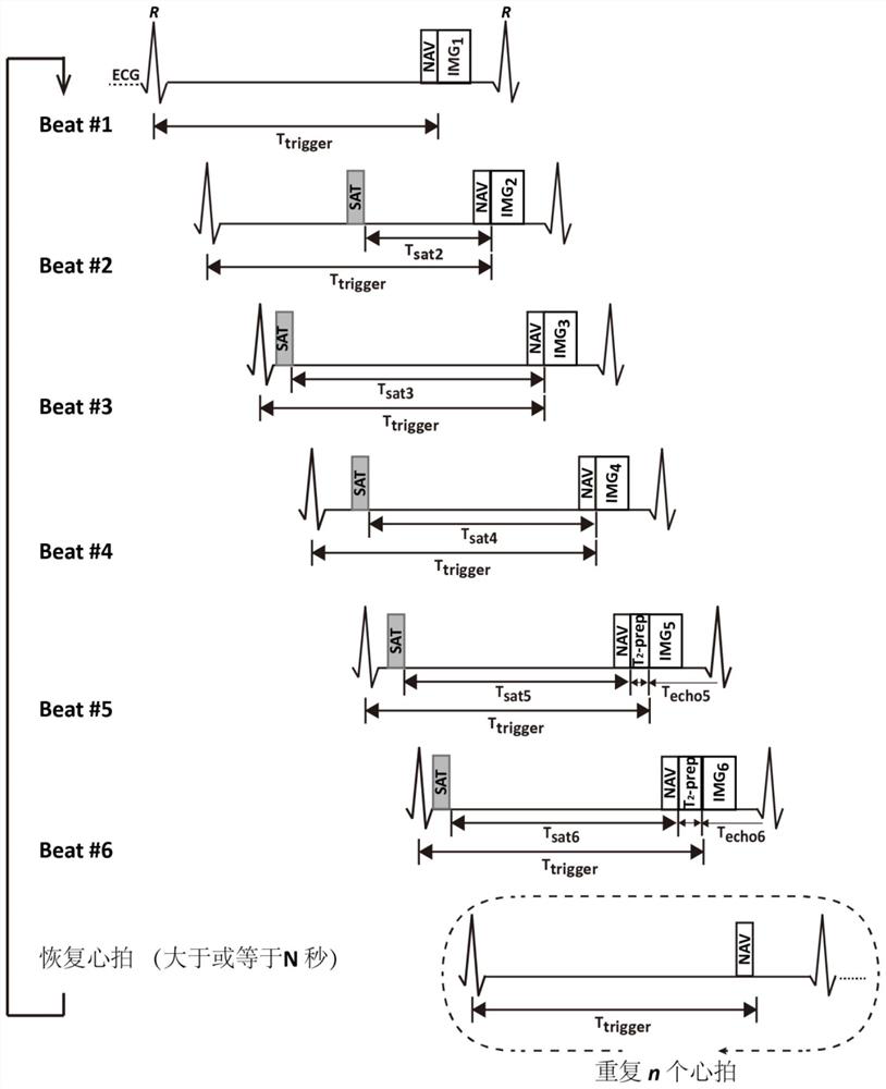 Quantitative myocardial magnetic resonance imaging method, equipment and storage medium