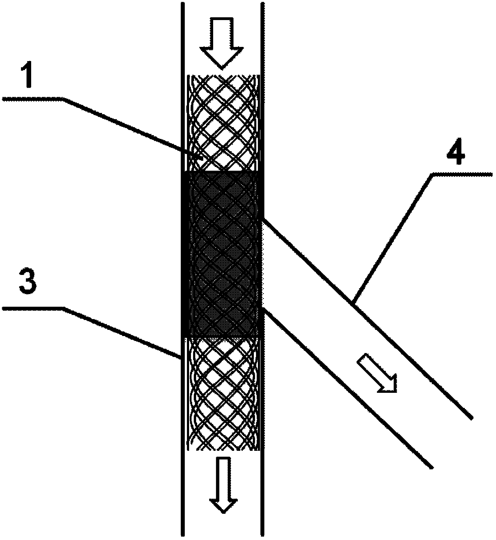 Medicinal coating stent