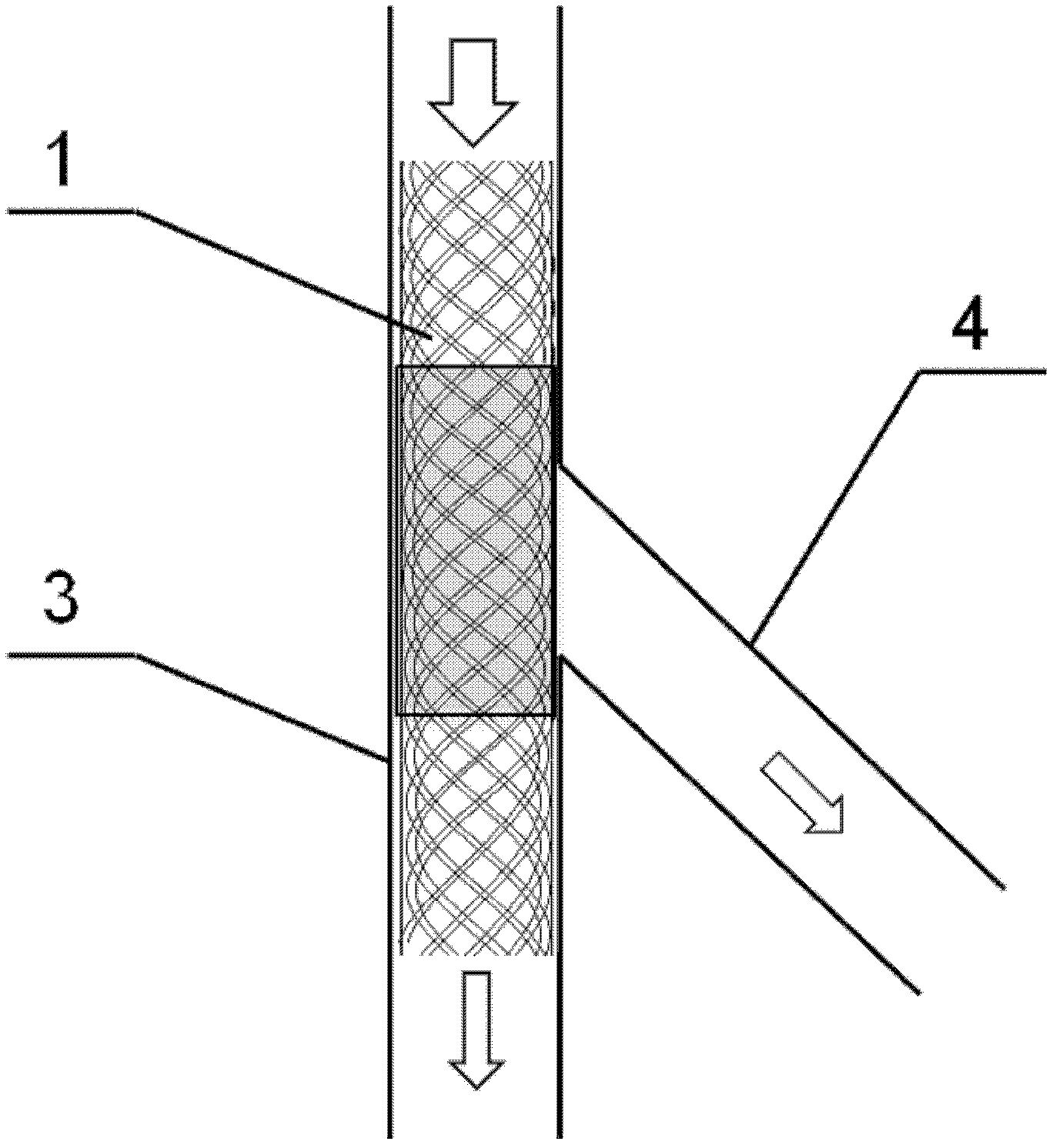 Medicinal coating stent